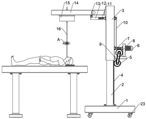 Electronic bronchoscope and auxiliary implantation manipulator thereof