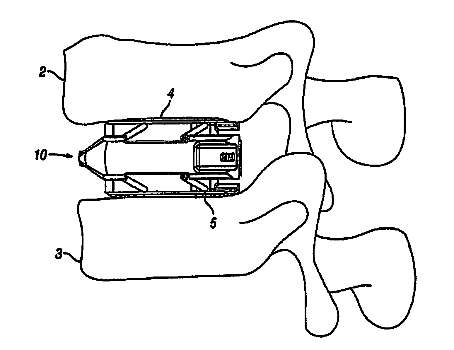 Expandable Fusion Device and Method of Installation Thereof