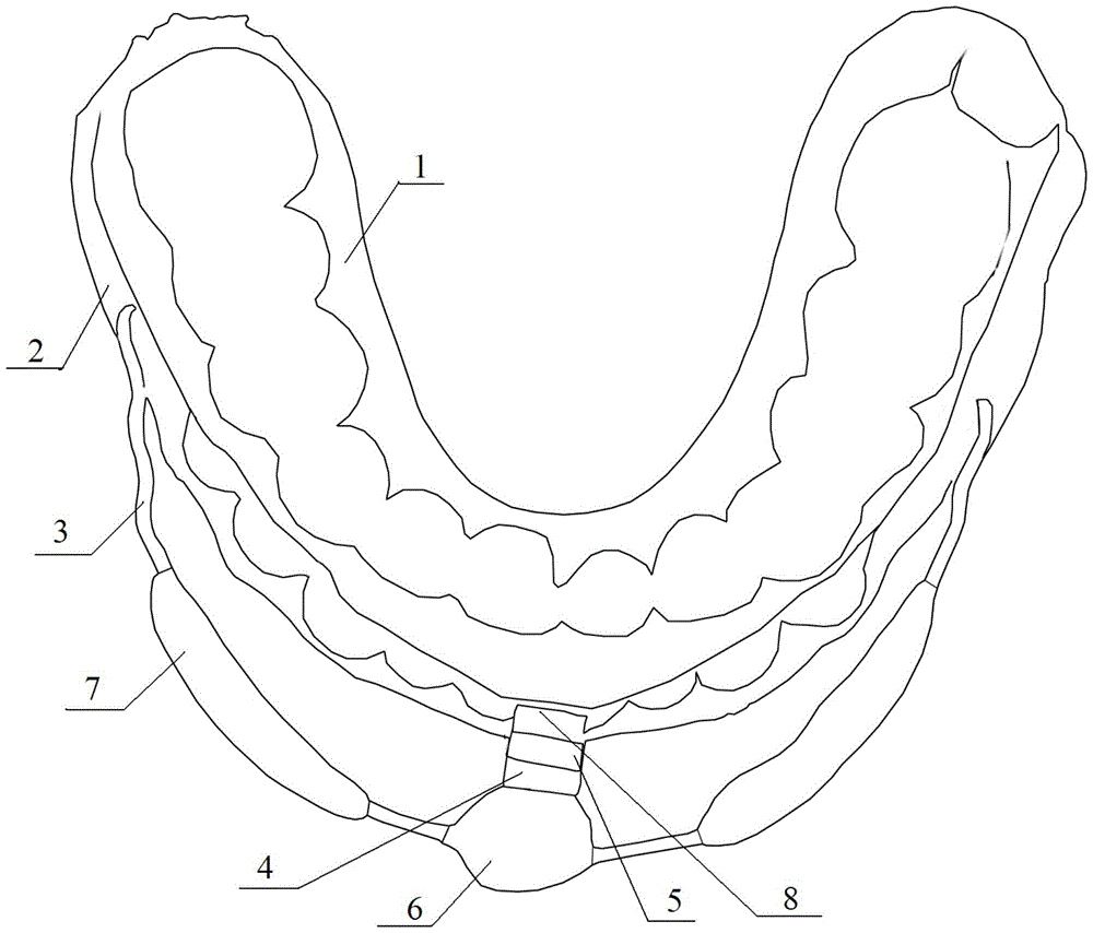 A magnetically guided oral function corrector