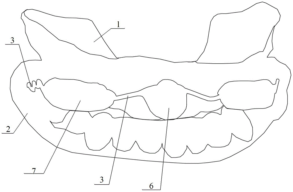 A magnetically guided oral function corrector