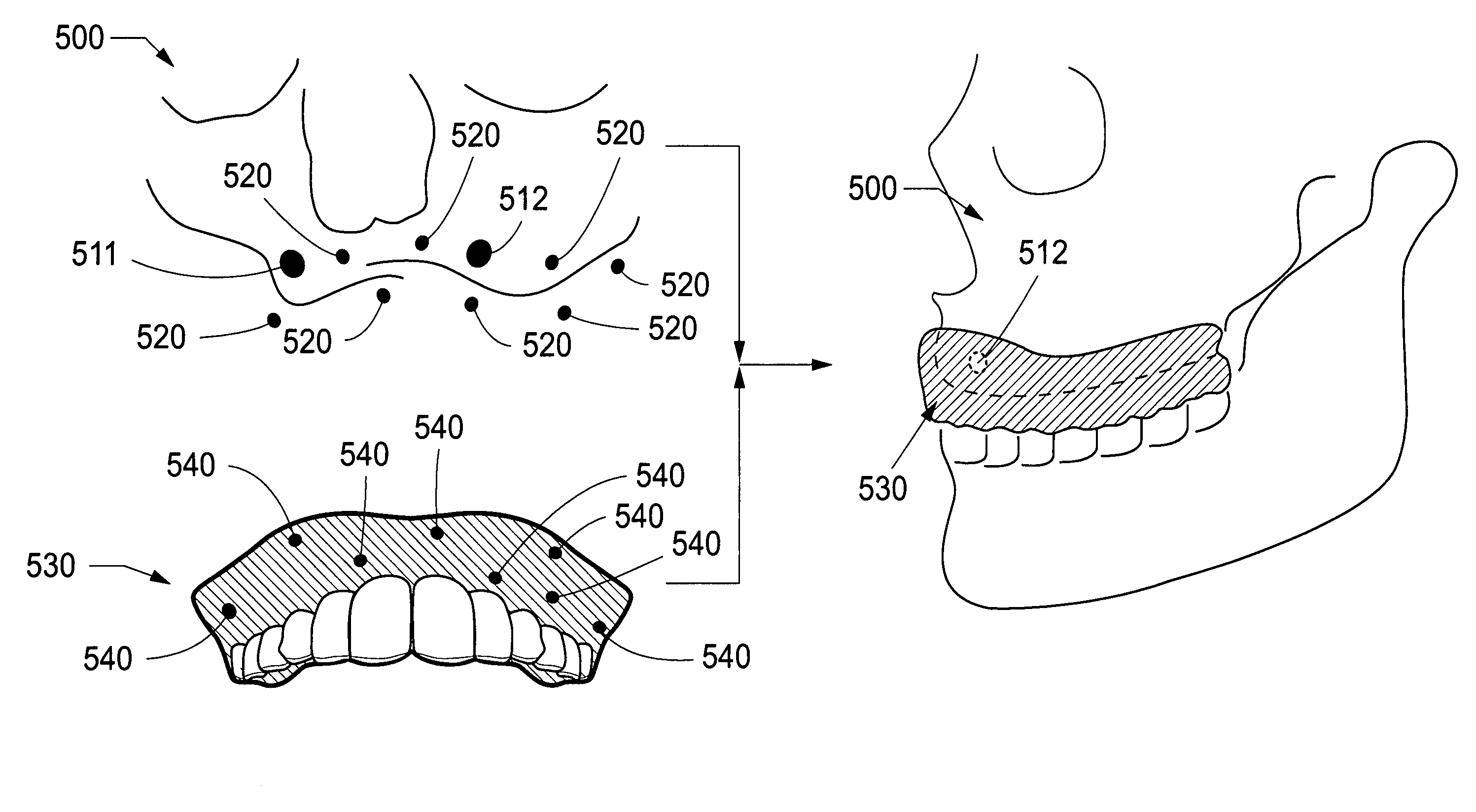 Repositioning of components related to cranial surgical procedures in a patient