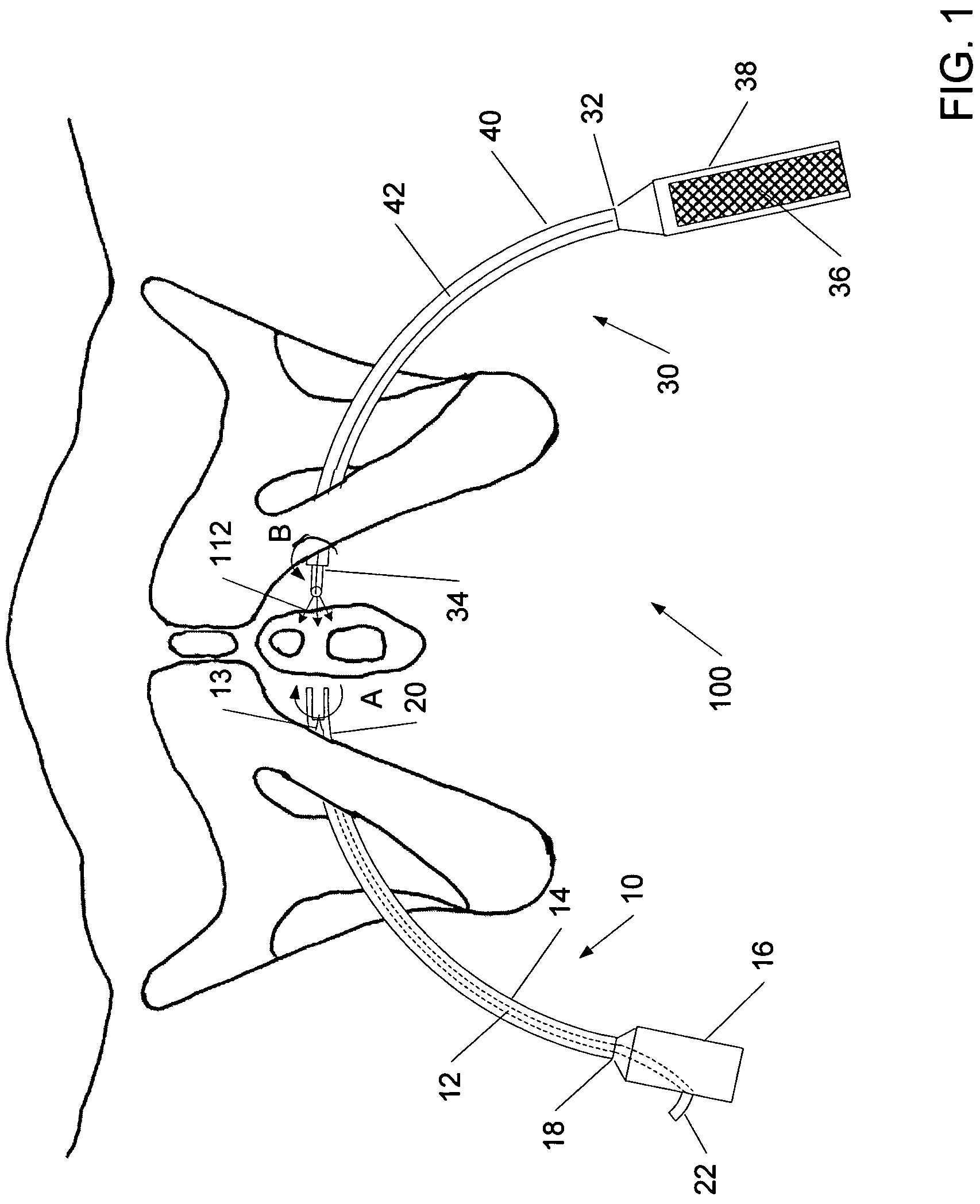 Devices for minimally invasive pelvic surgery