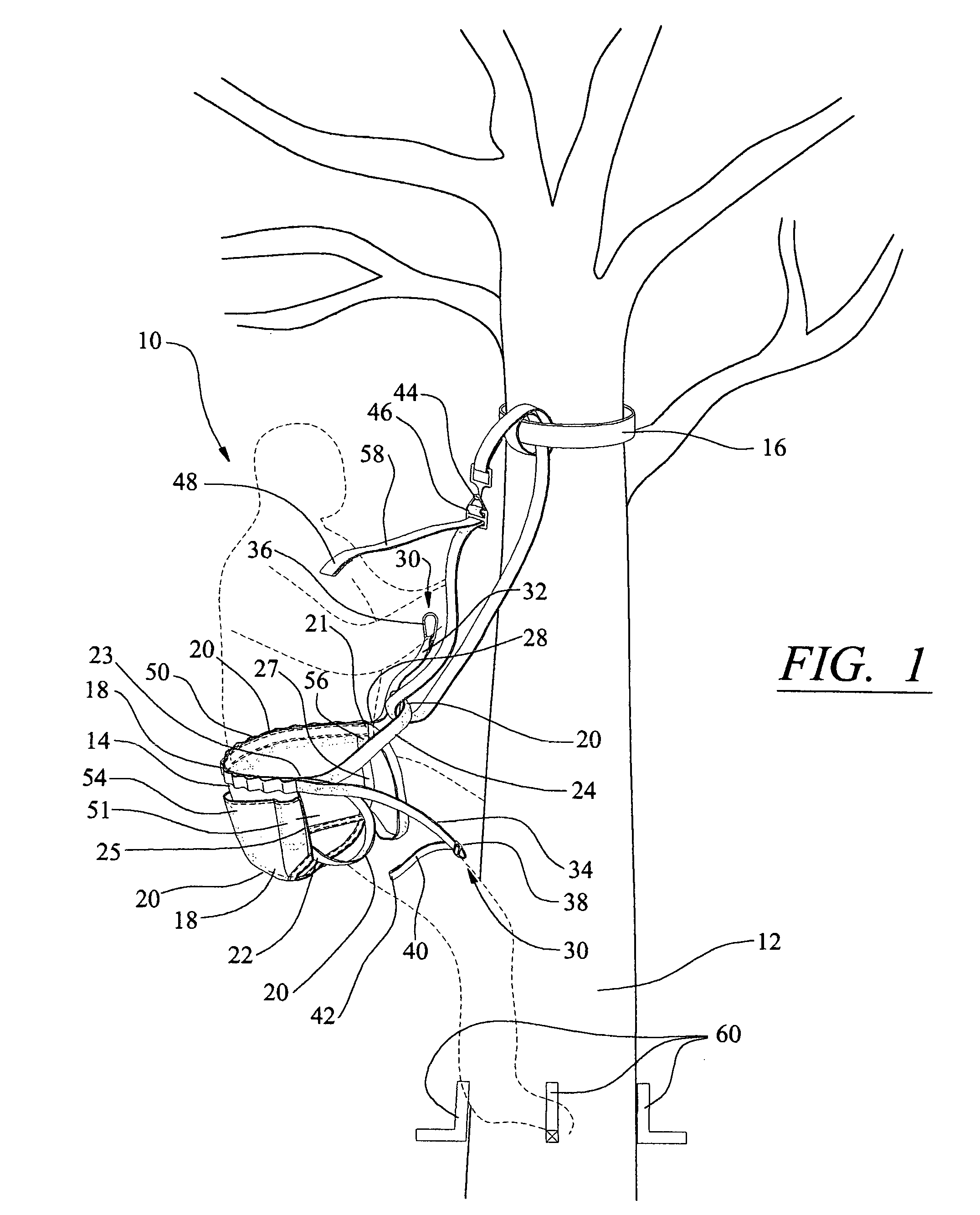 Support harness