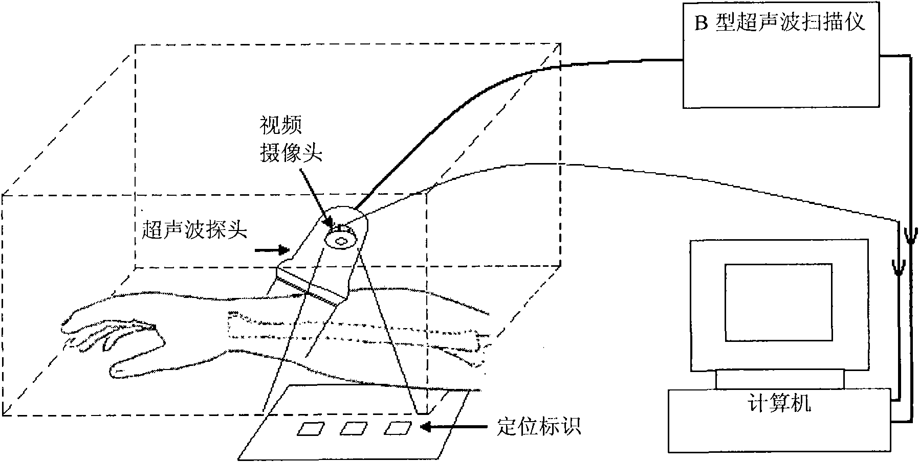 Three-dimensional ultrasonic imaging system