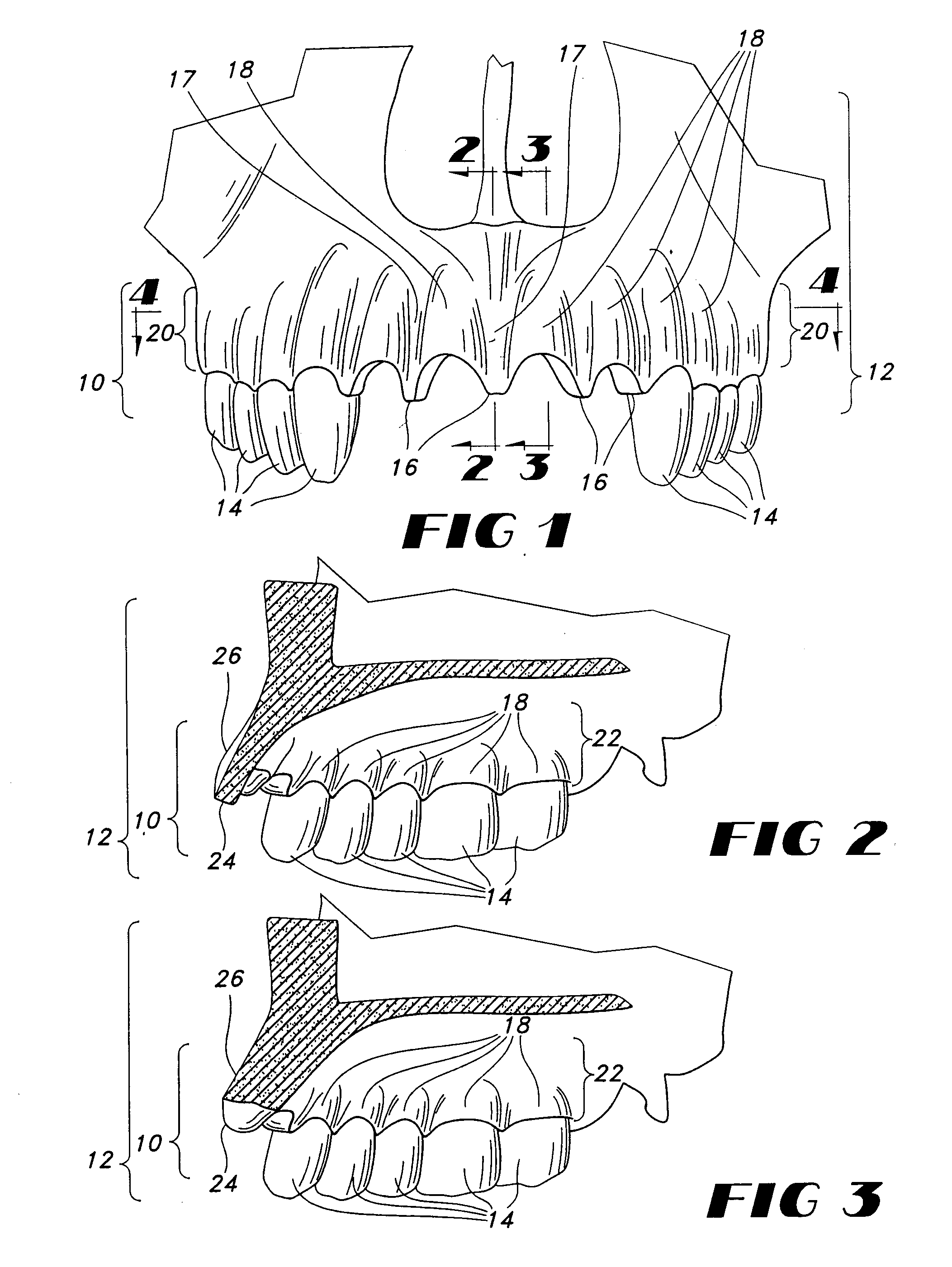 Biocompatible form and method of fabrication