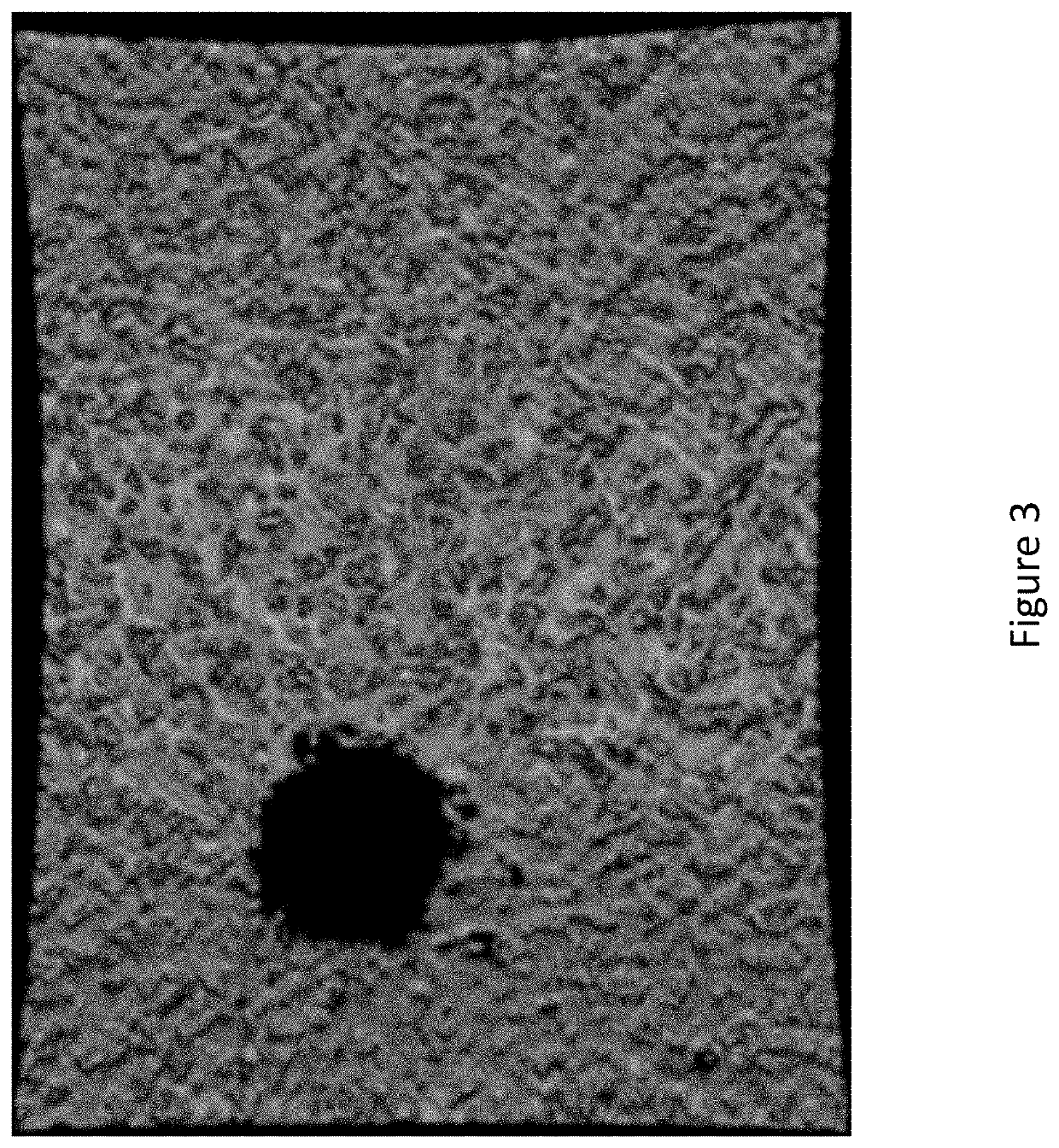 3D analysis with optical coherence tomography images