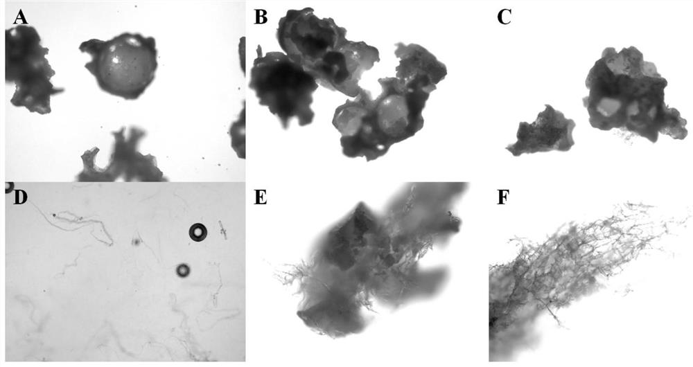 Collagen/biological ceramic porous bone implant and preparation method thereof