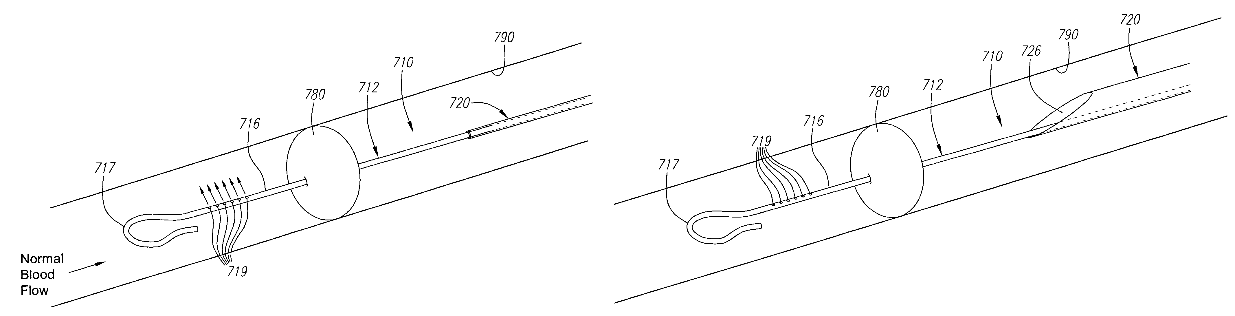 Expandable guide sheath and apparatus with distal protection and methods for use