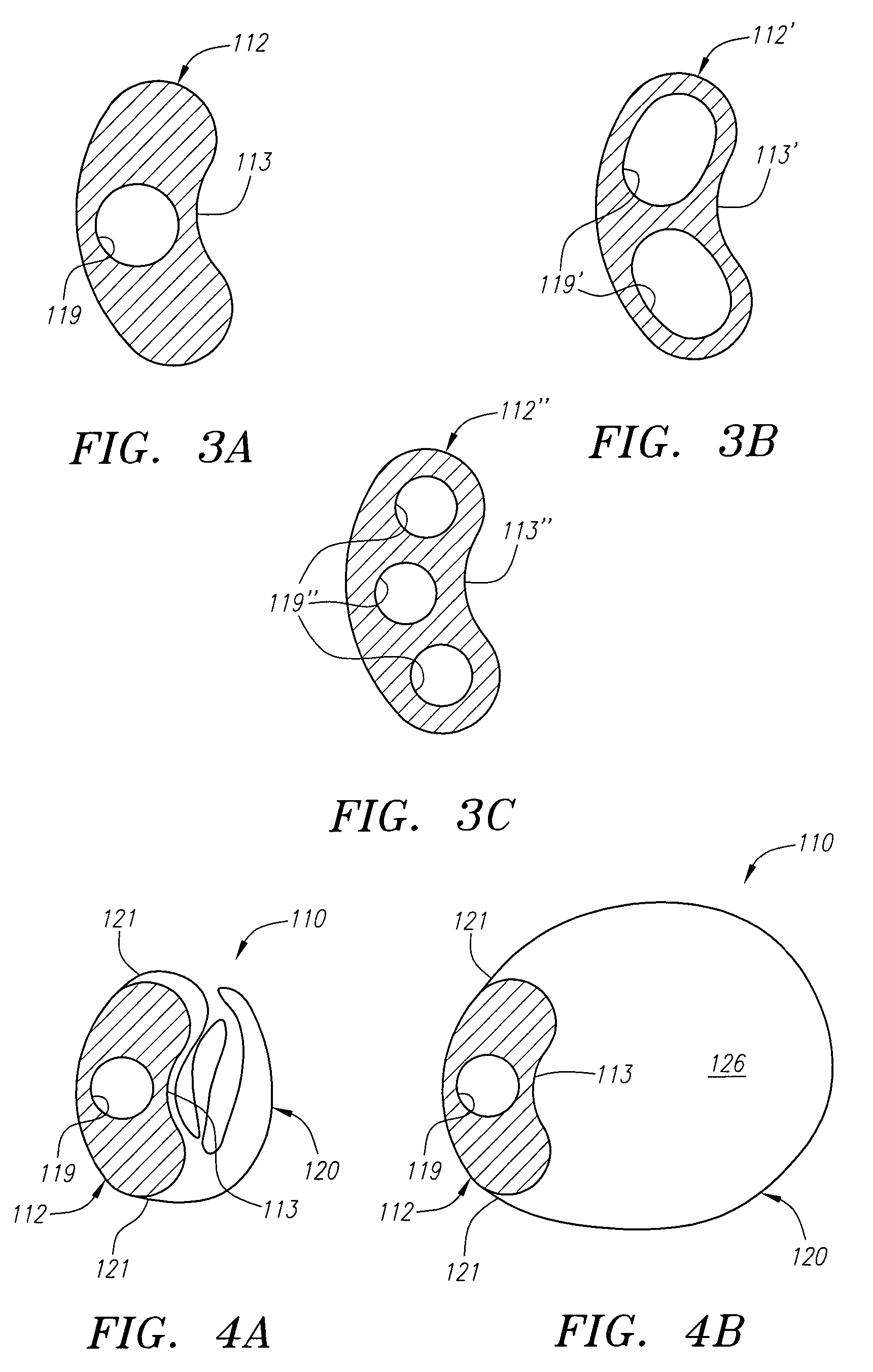 Expandable guide sheath and apparatus with distal protection and methods for use