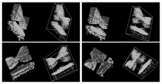 OCT eye fundus image data registration method