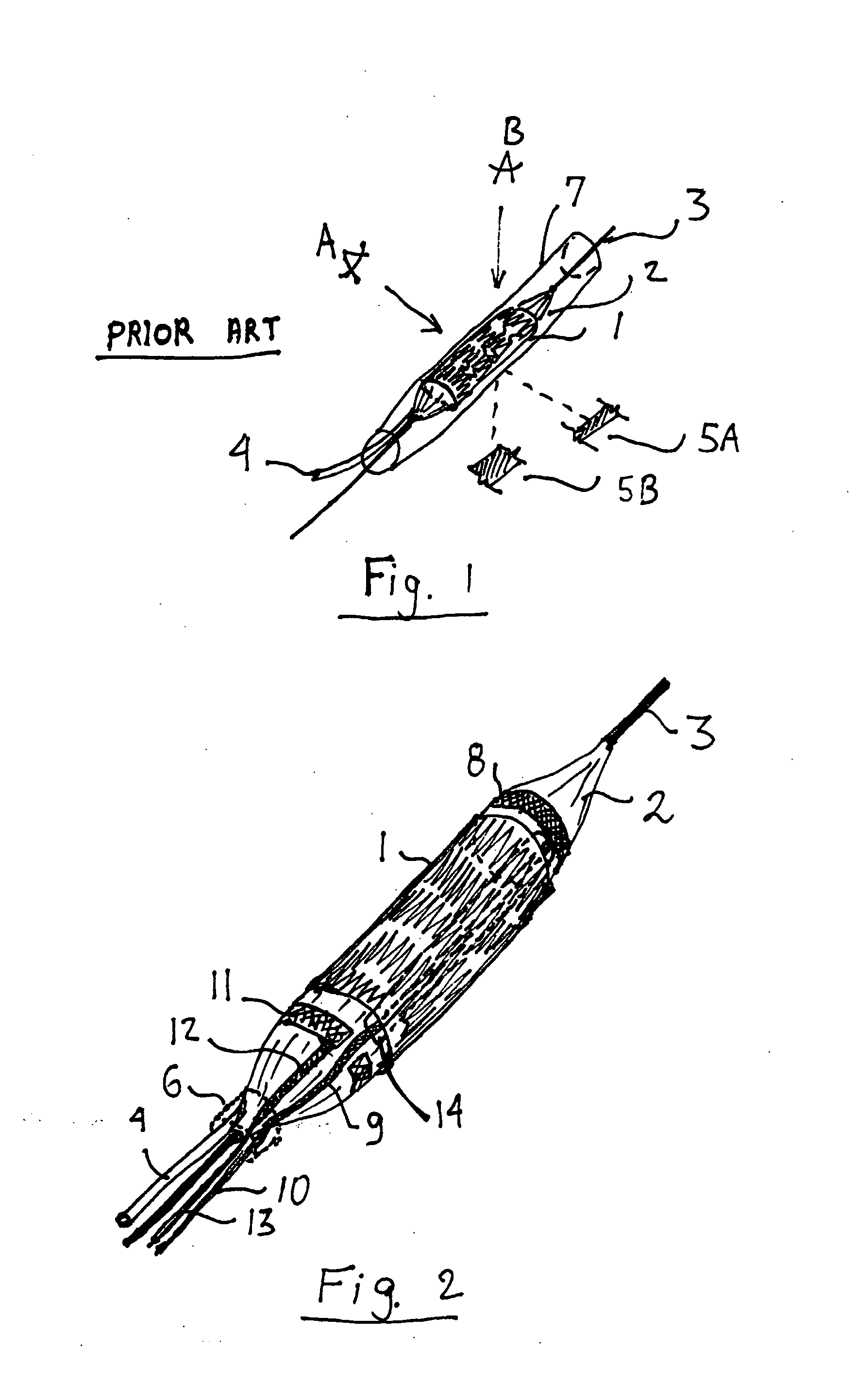 Lumen diameter and stent apposition sensing