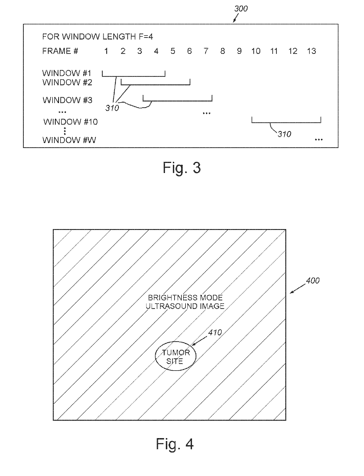 System and method for imaging and localization of contrast-enhanced features in the presence of accumulating contrast agent in a body