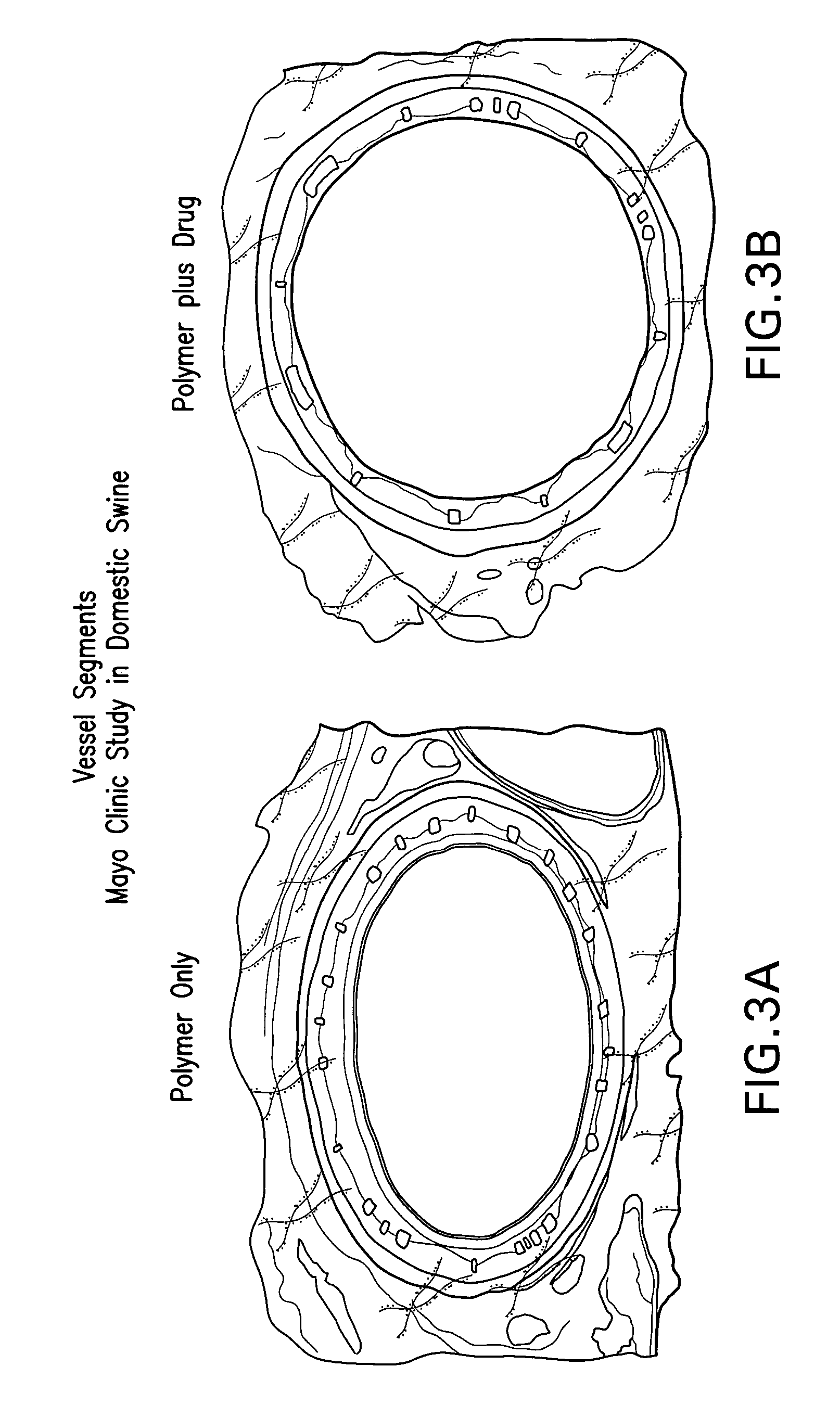 Delivery of highly lipophilic agents via medical devices