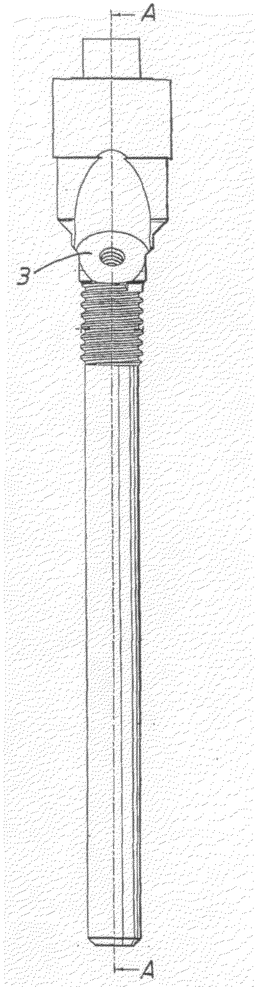 Implant arrangement