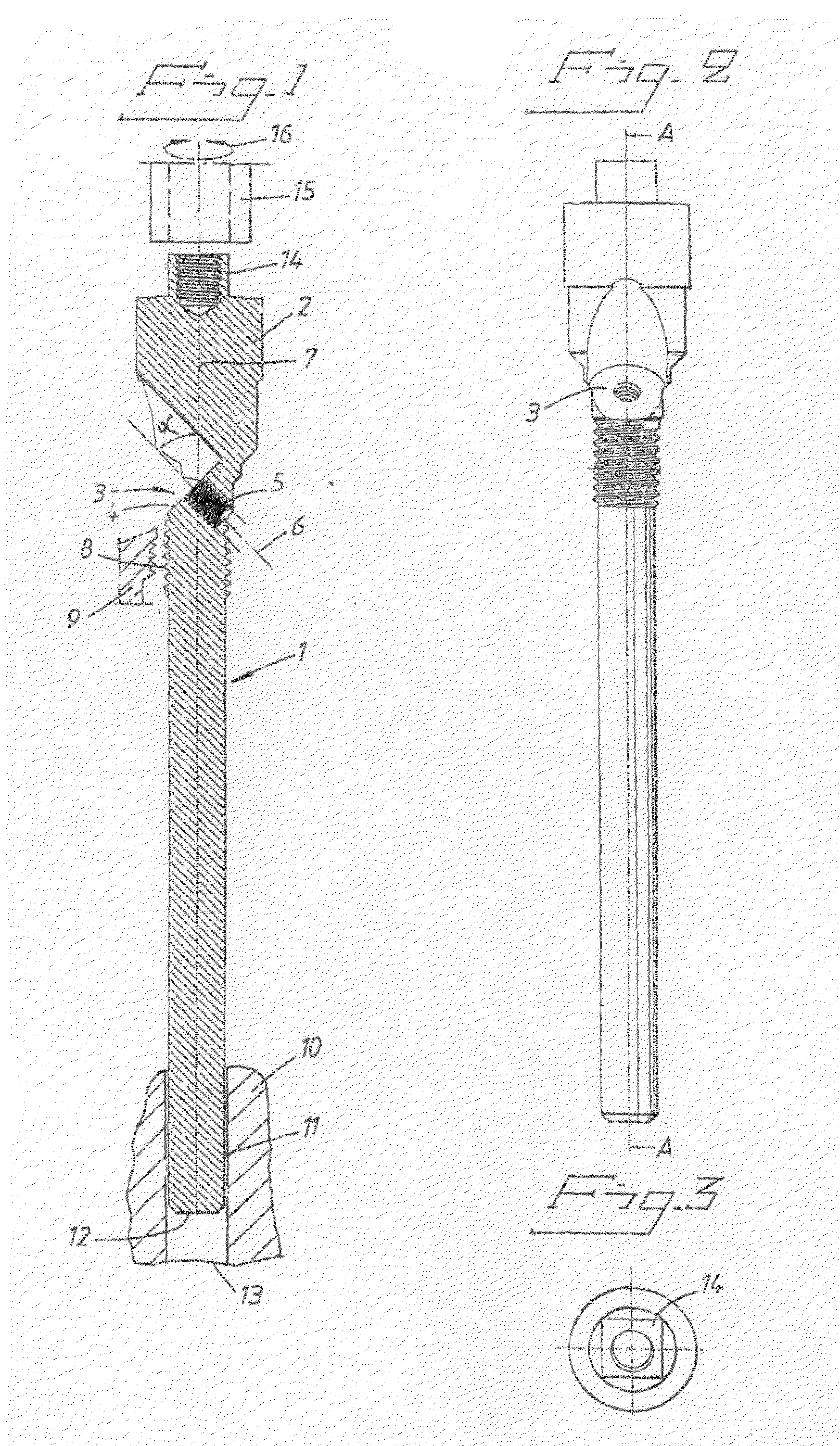 Implant arrangement