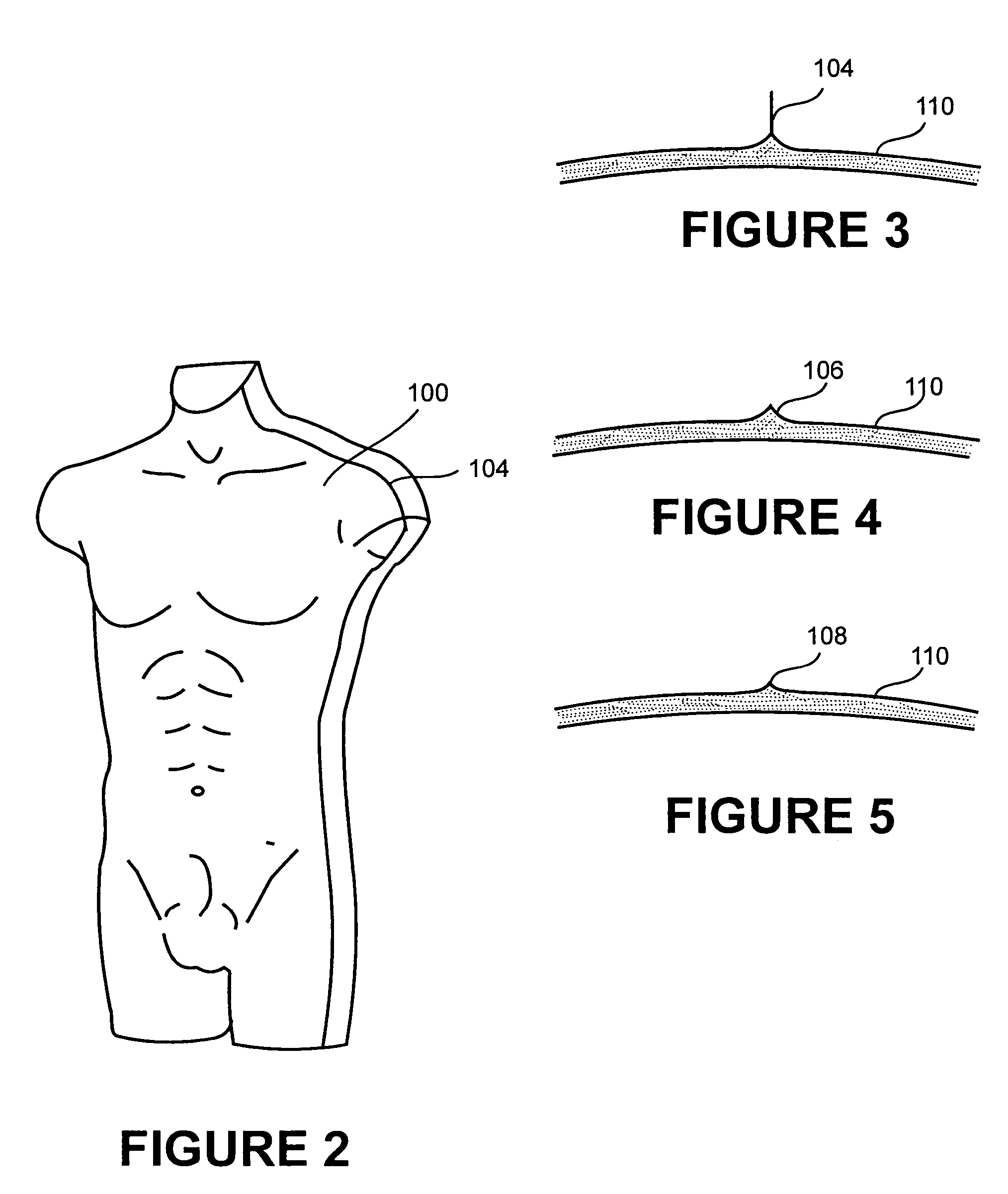 Molded display forms