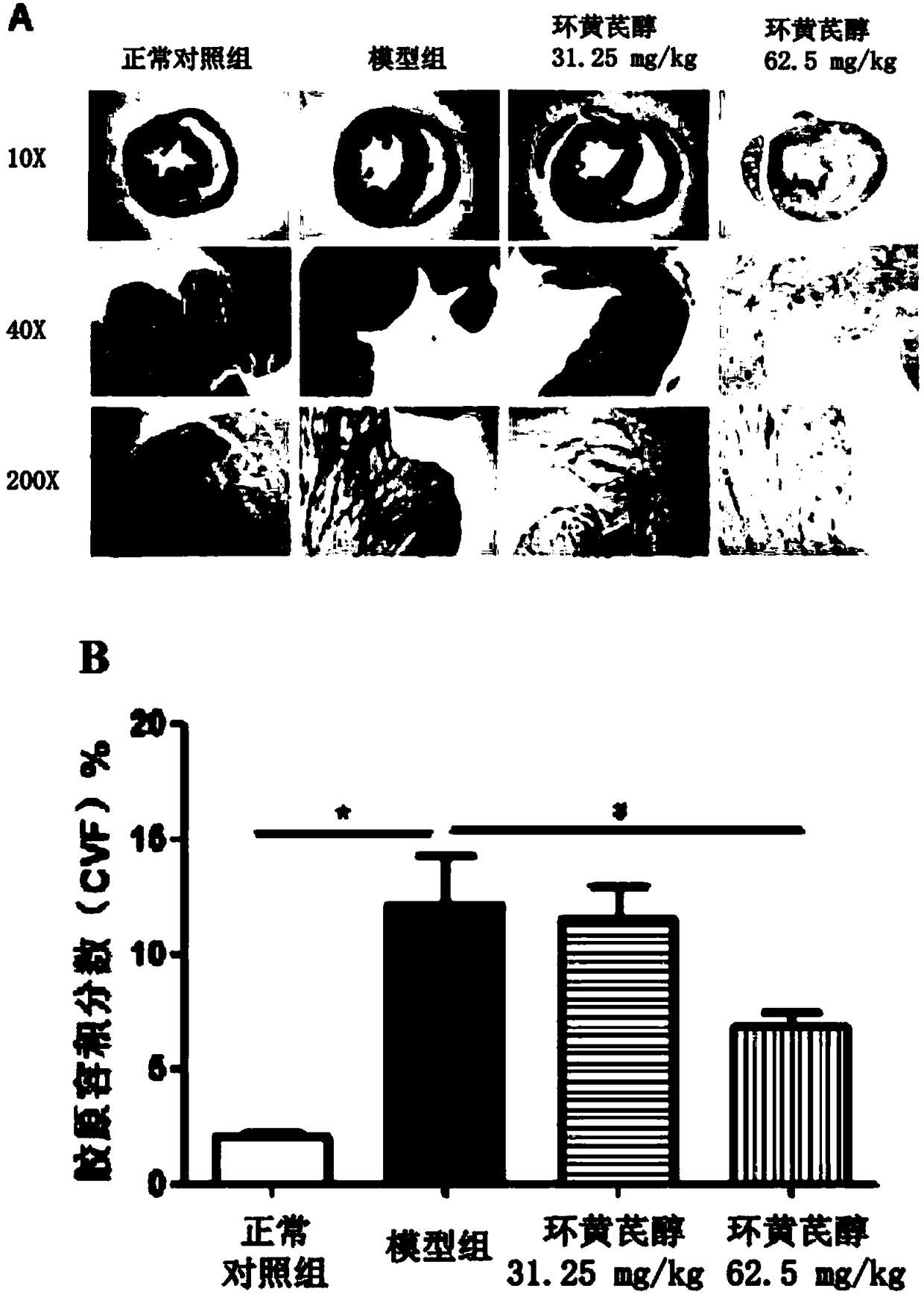 Application of cycloastragenol in prevention and treatment of myocardial fibrosis