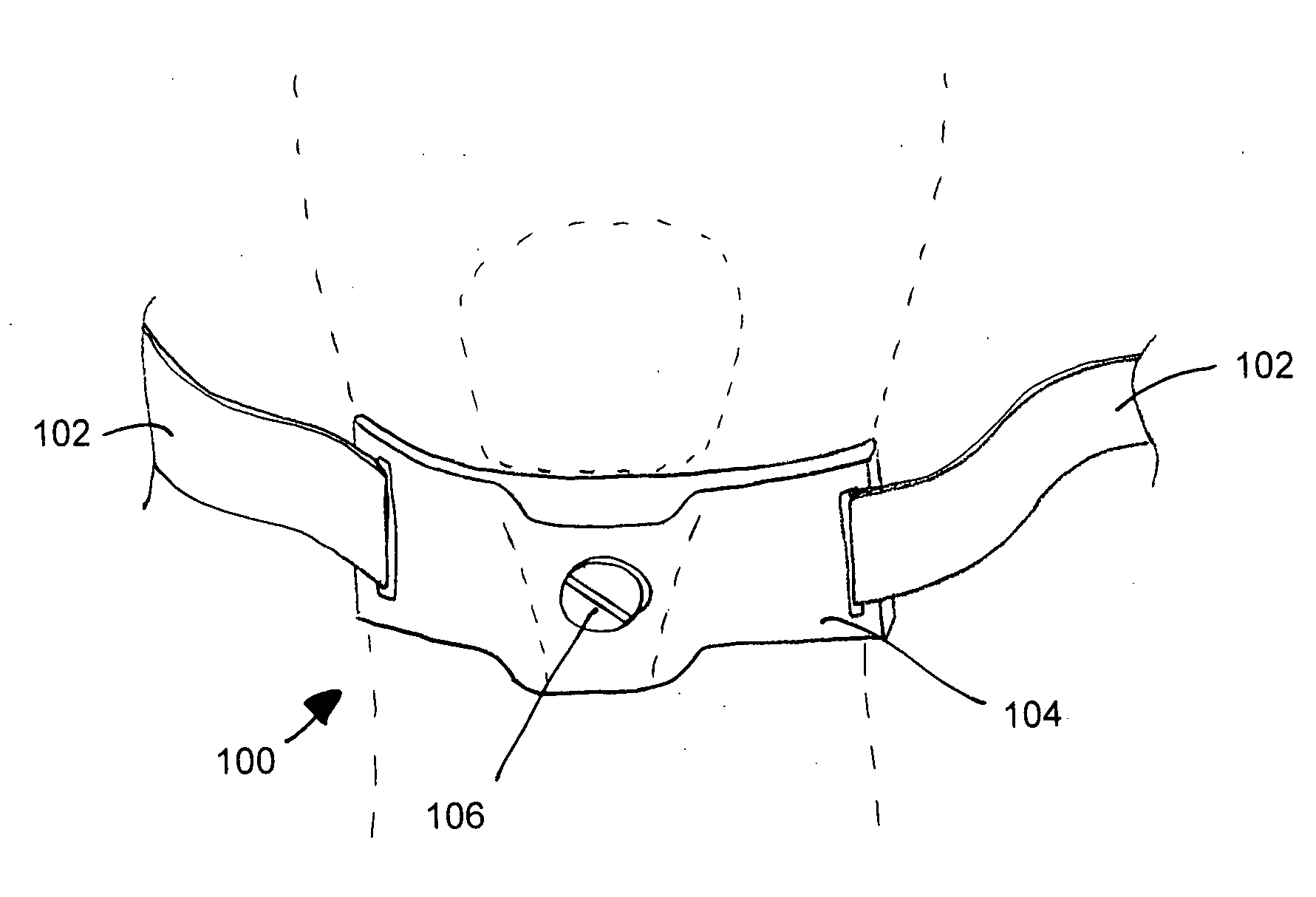 Adjustable tissue compression device