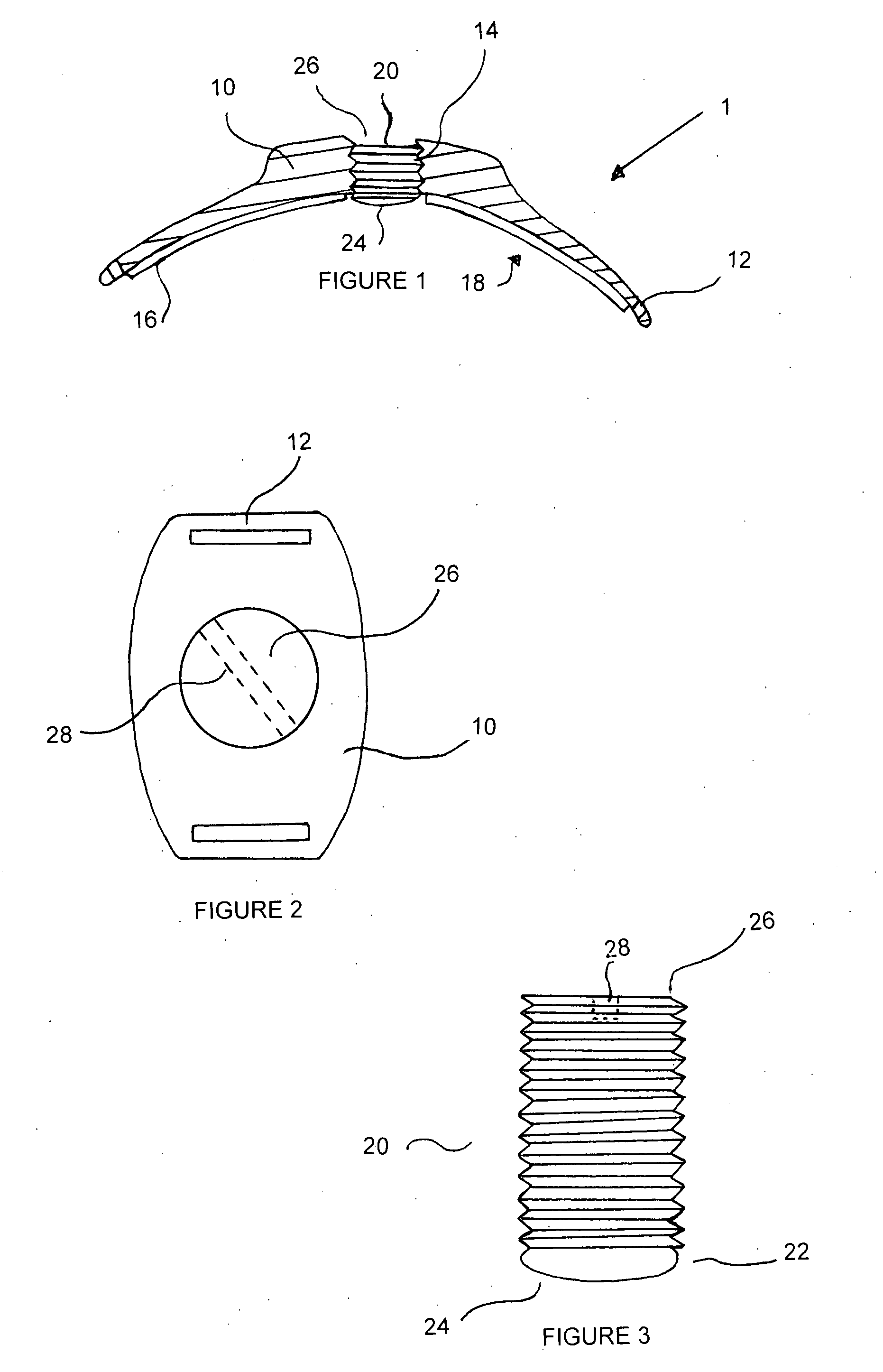 Adjustable tissue compression device