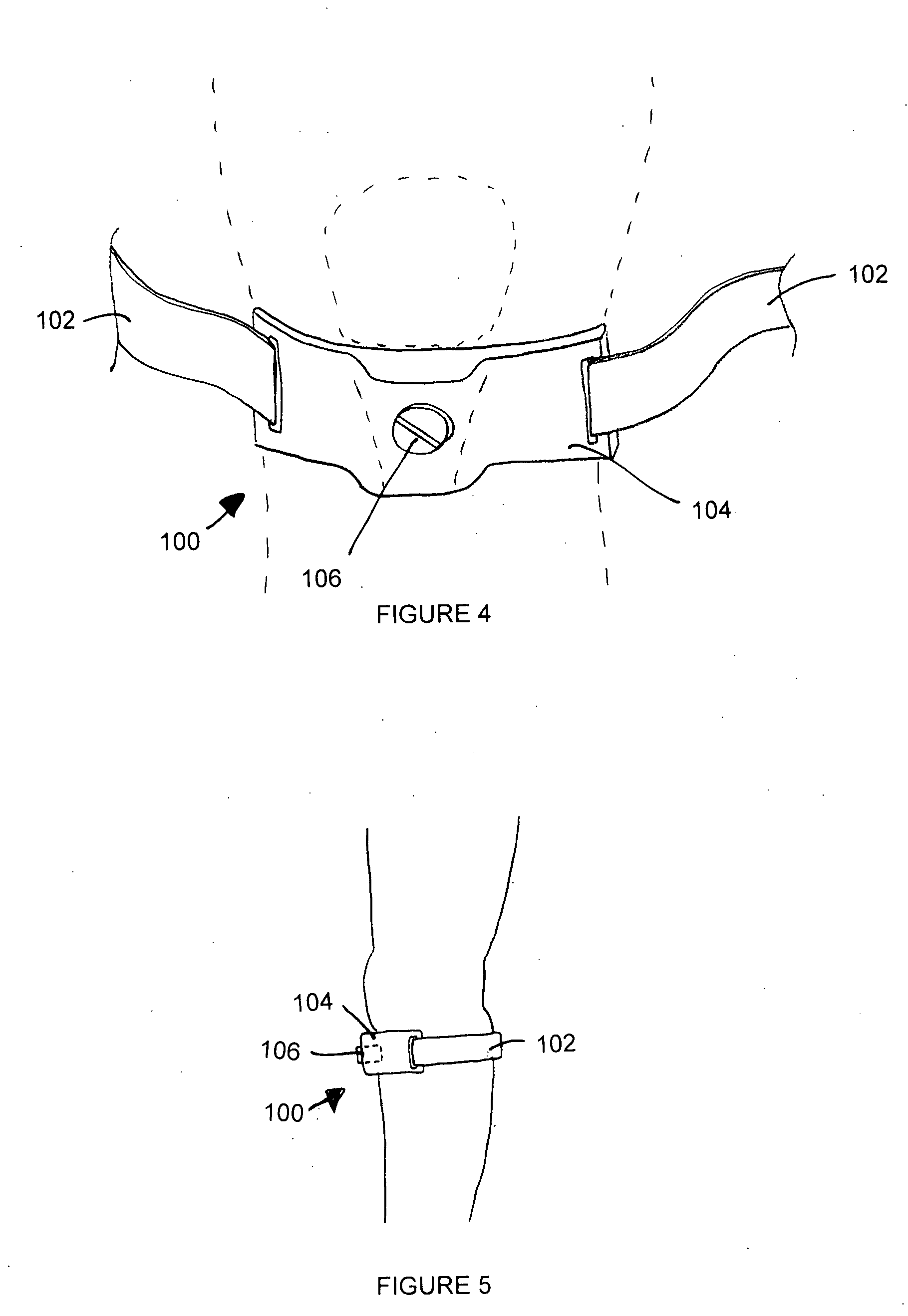 Adjustable tissue compression device