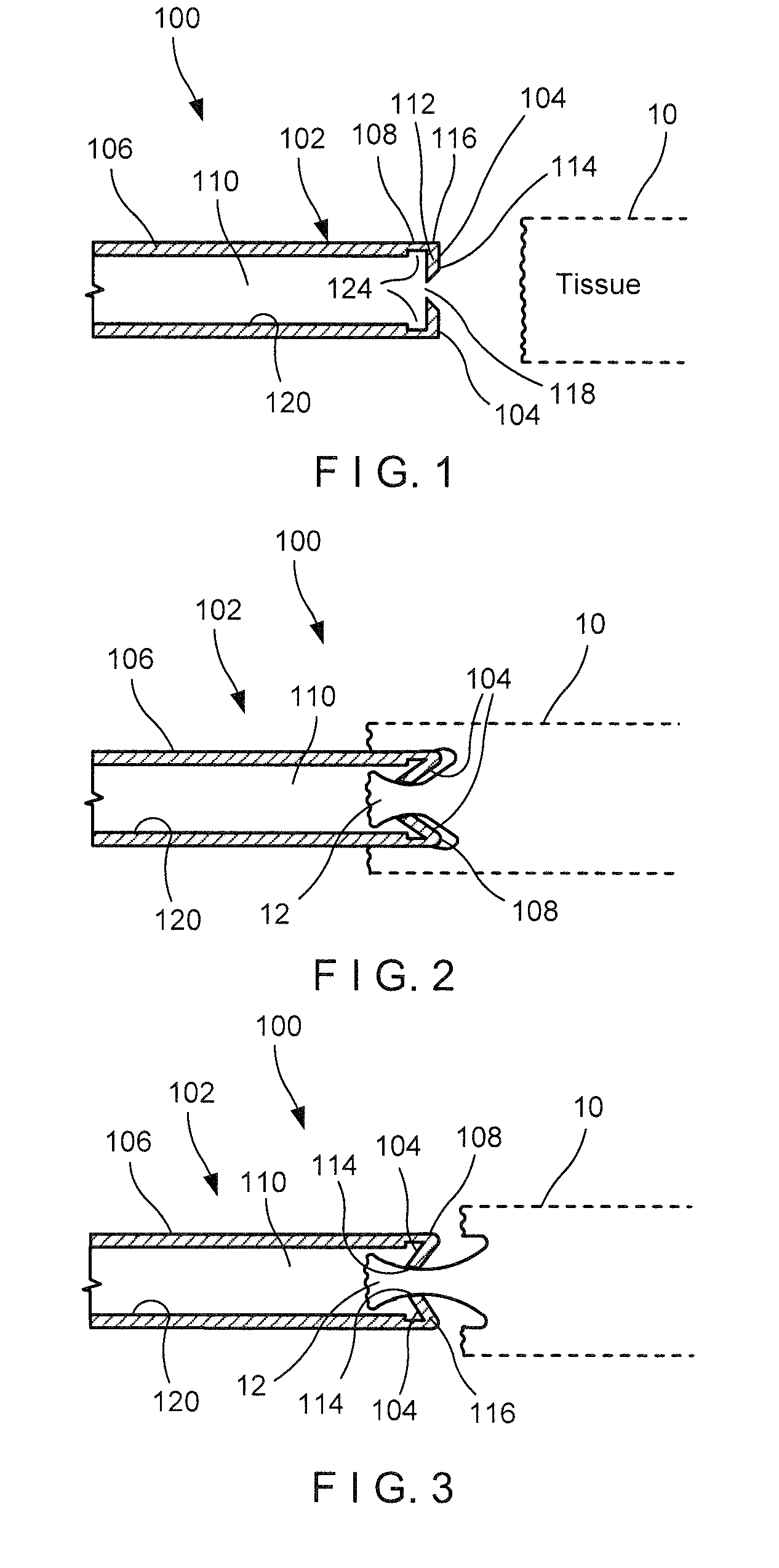 Endoscopic biopsy one-way trap