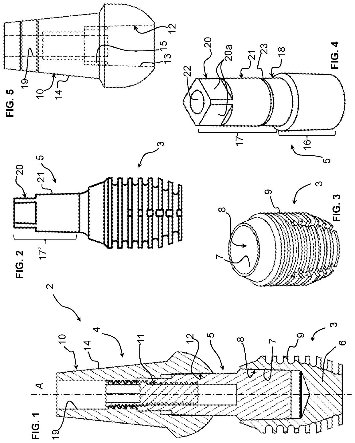 Dental implant assembly