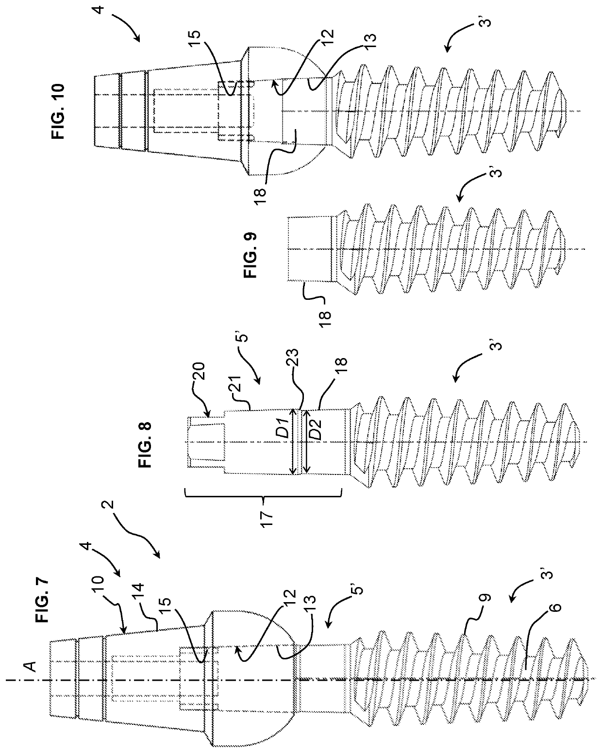 Dental implant assembly