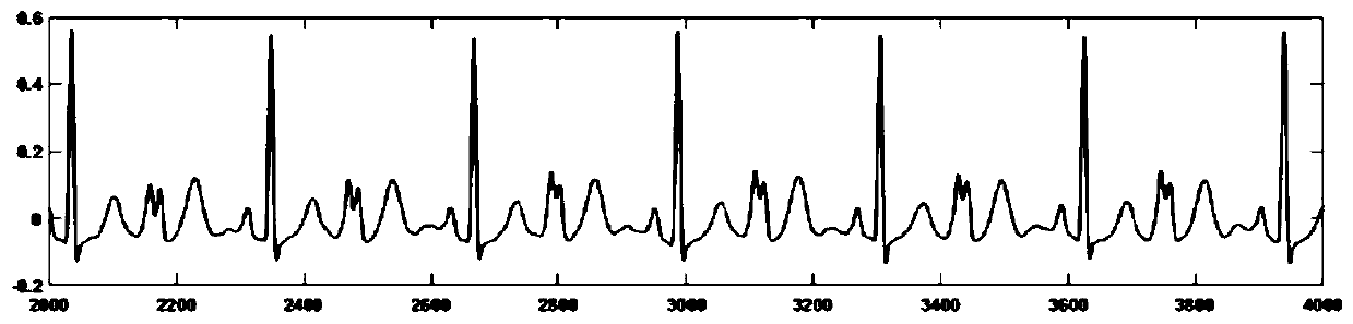 Method and device for monitoring blood pressure wave form