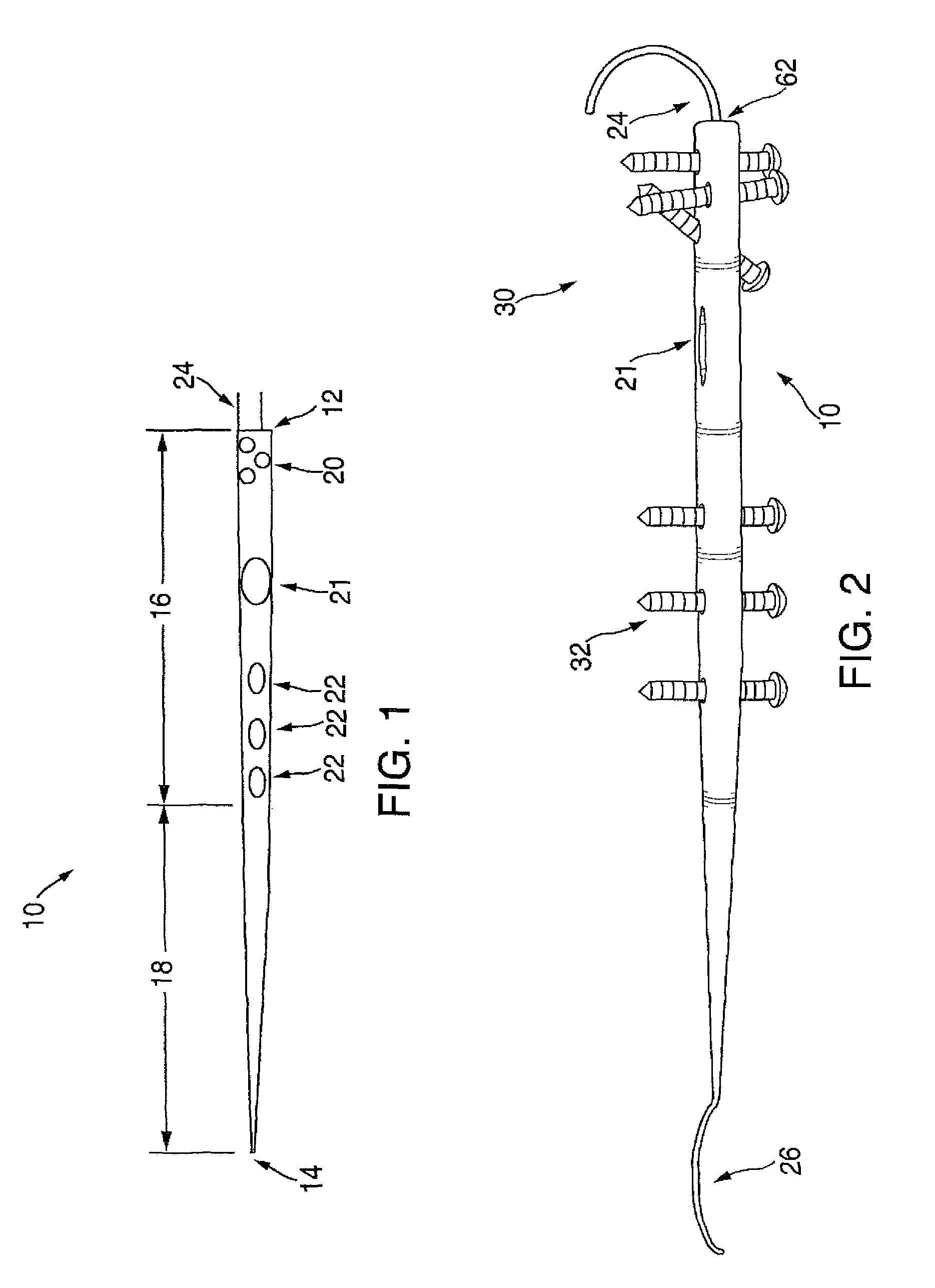 Fixation device for proximal elbow fractures and method of using same