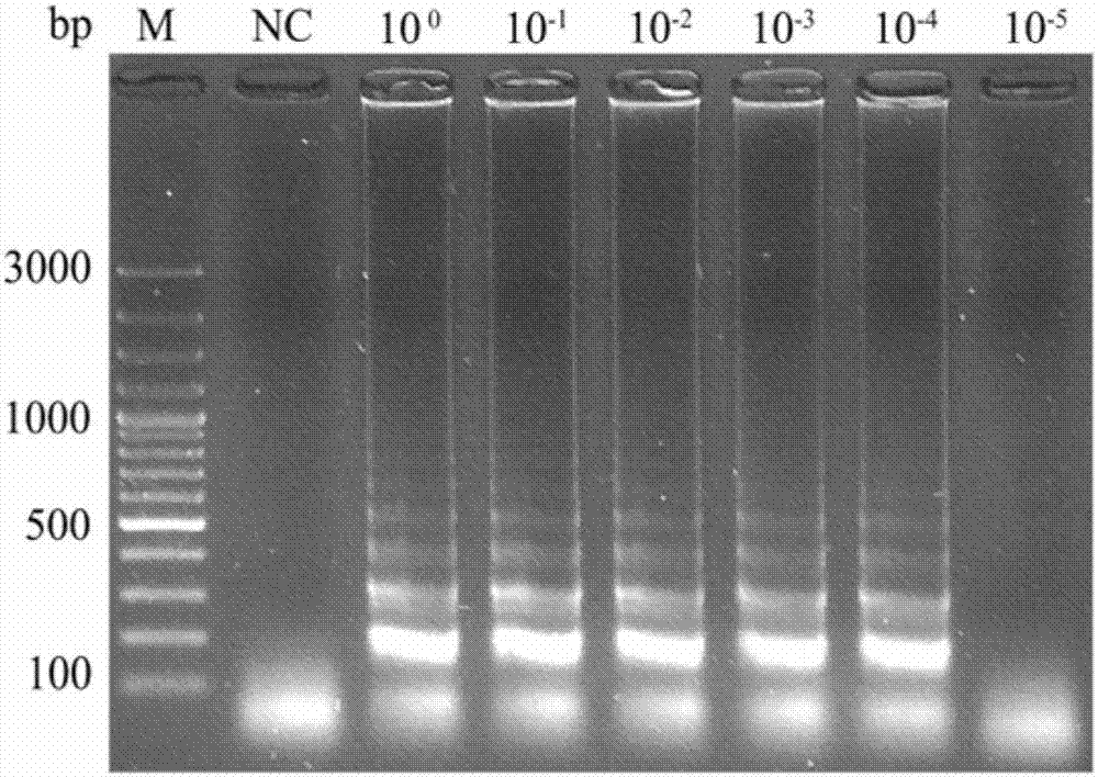 Primer for LAMP-LFD (loop-mediated isothermal amplification-lateral flow dipstick) detection of anisakis simplex/anisakis paasche and probe sequence