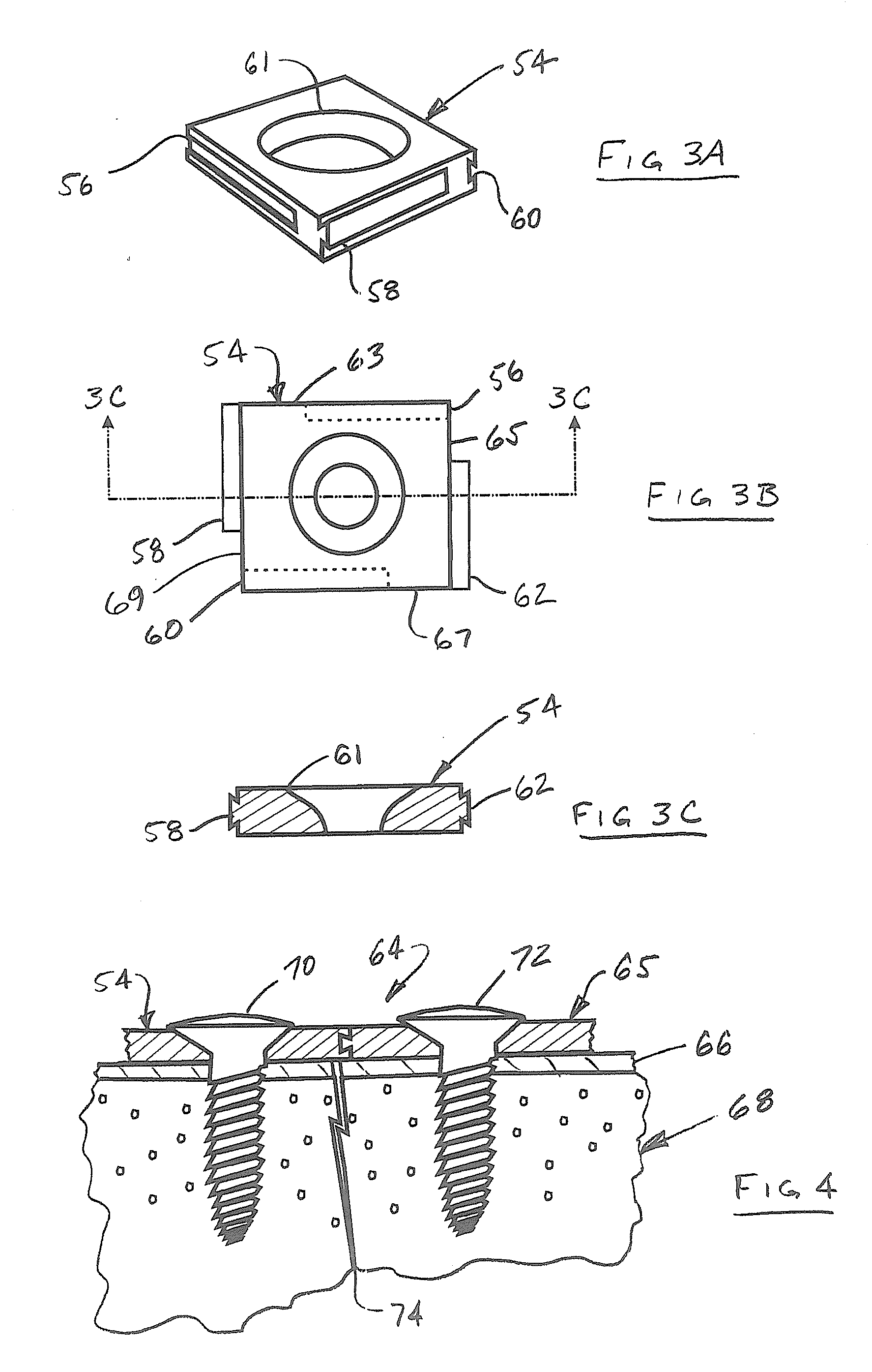 Bone fixation system