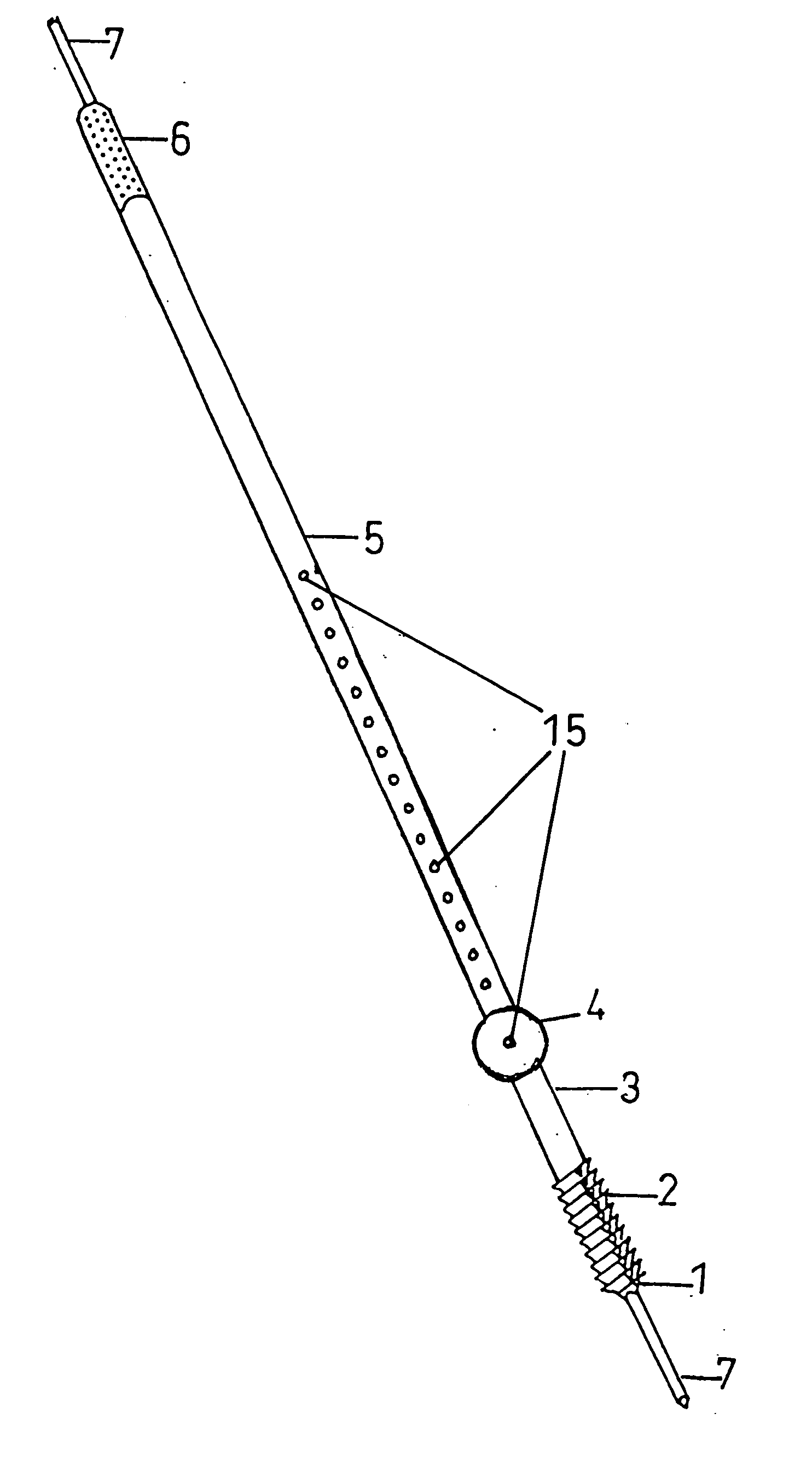 Renew compression screw