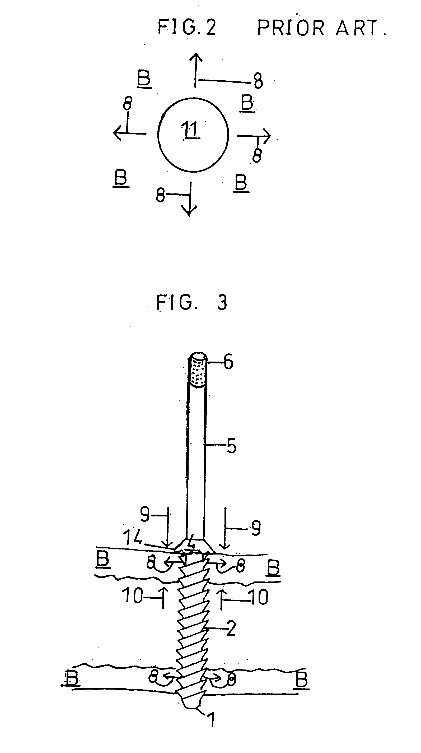 Renew compression screw