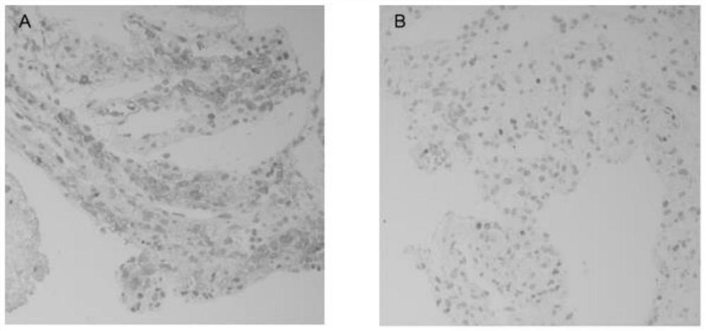 Method for separating and purifying follicular cells