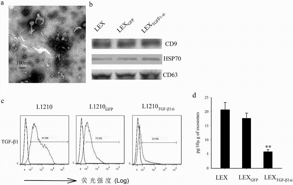 Interference sequence-modified TGF-beta1 silent leukemia cell exosome and preparation method and application thereof