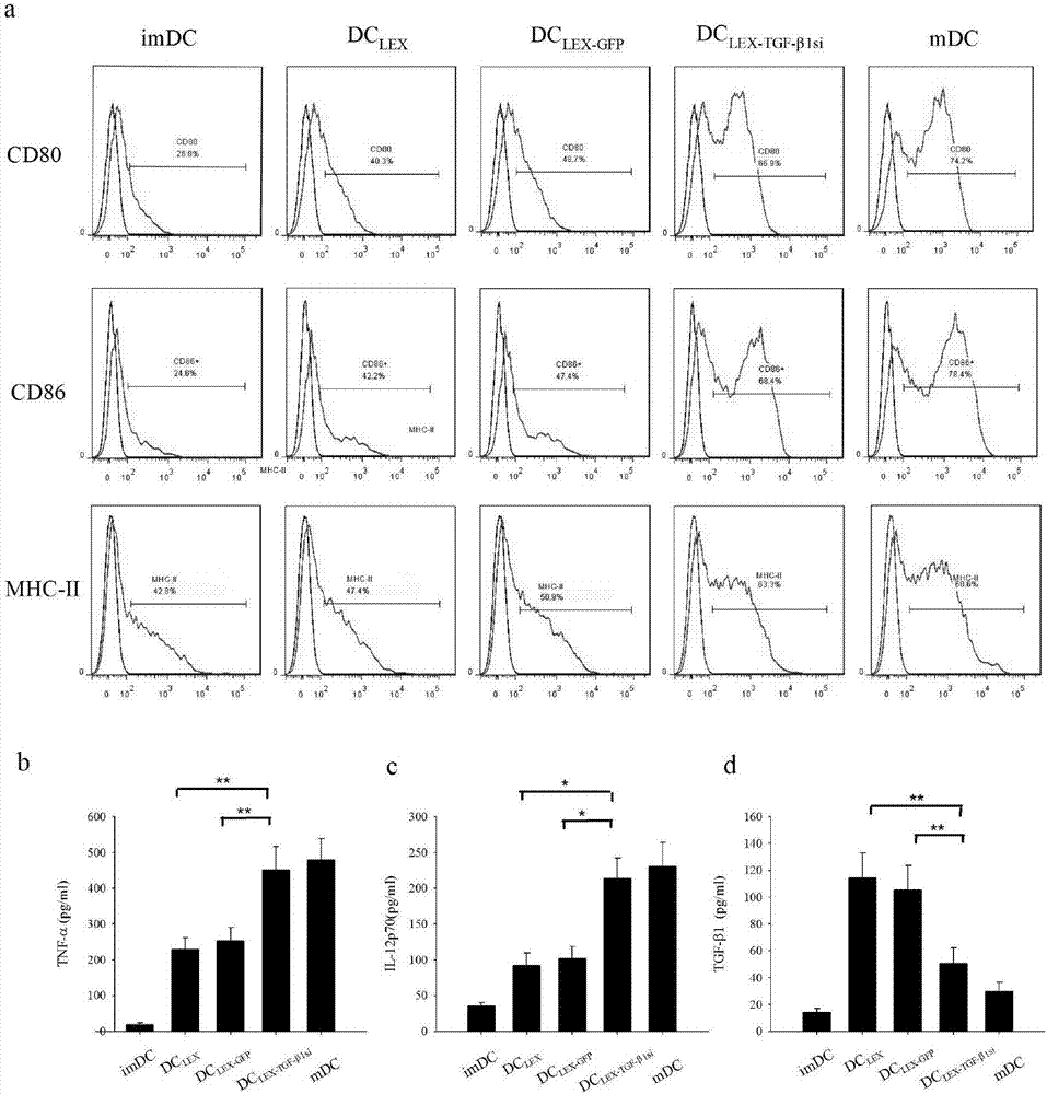 Interference sequence-modified TGF-beta1 silent leukemia cell exosome and preparation method and application thereof