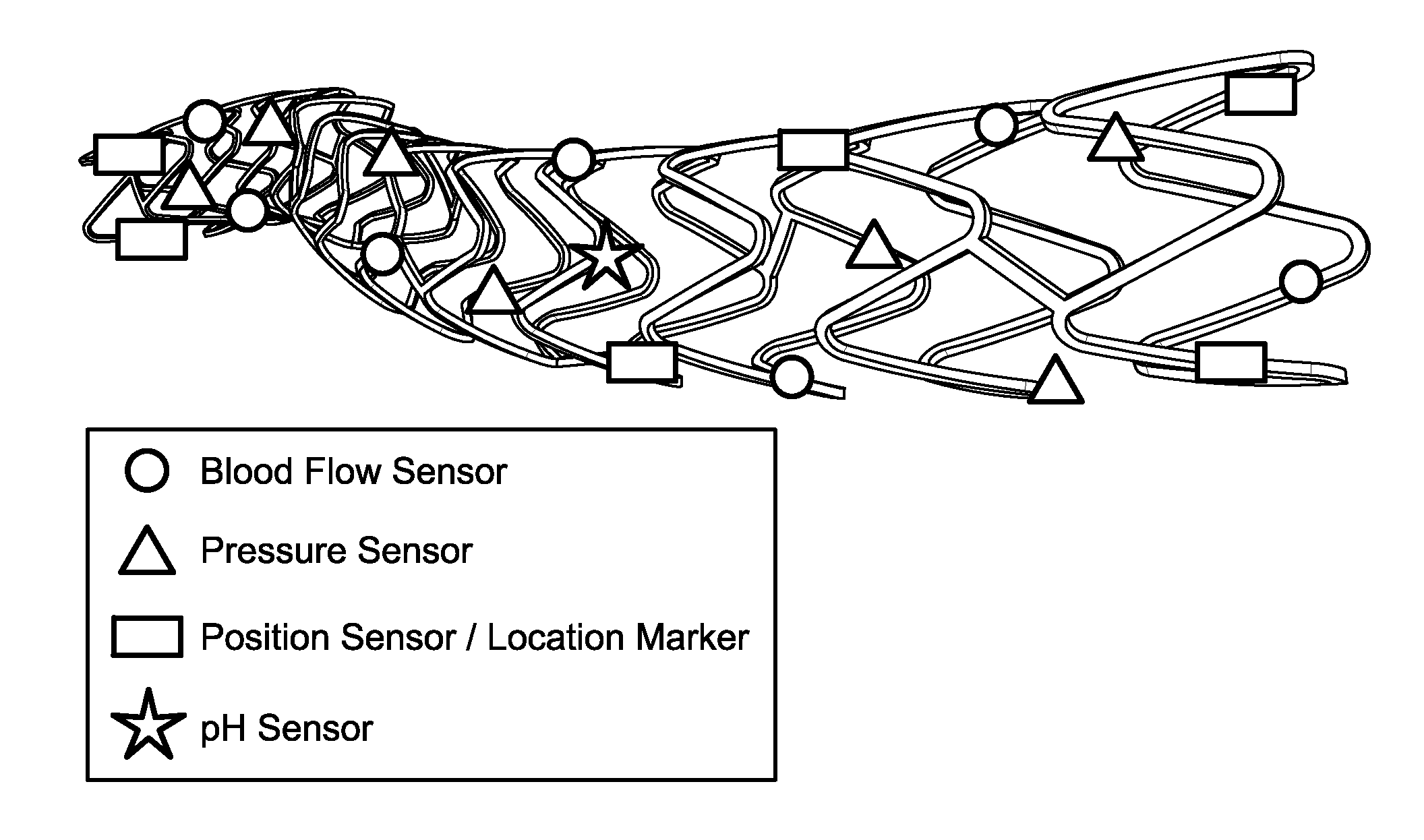 Stent monitoring assembly and method of use thereof