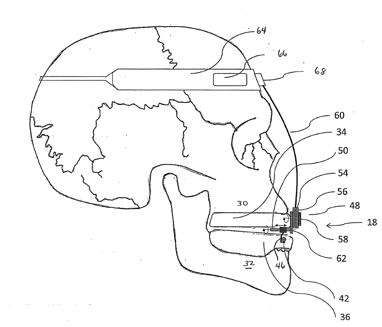 System and method for sensor driven intelligent oral appliance