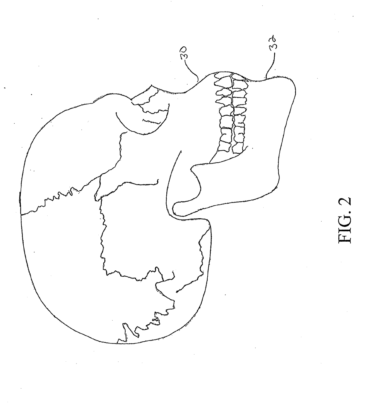 System and method for sensor driven intelligent oral appliance