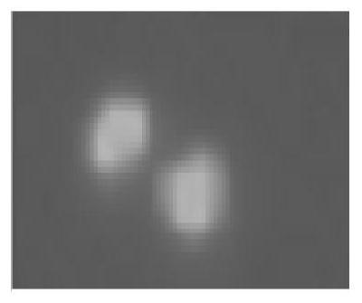 Detection kit for peripheral blood circulating tumor cells of small cell lung cancer patient and PD-L1