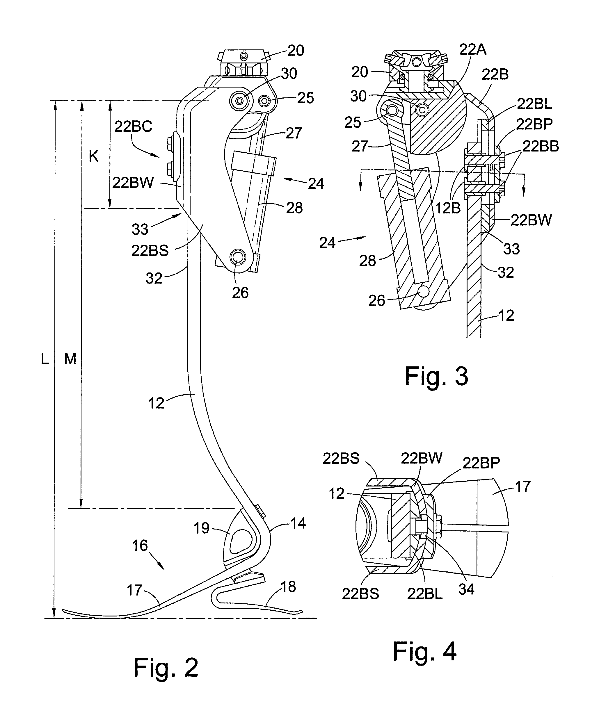 Leg Prosthesis