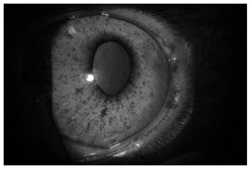 Preparation method and application of a kind of keratitis animal model