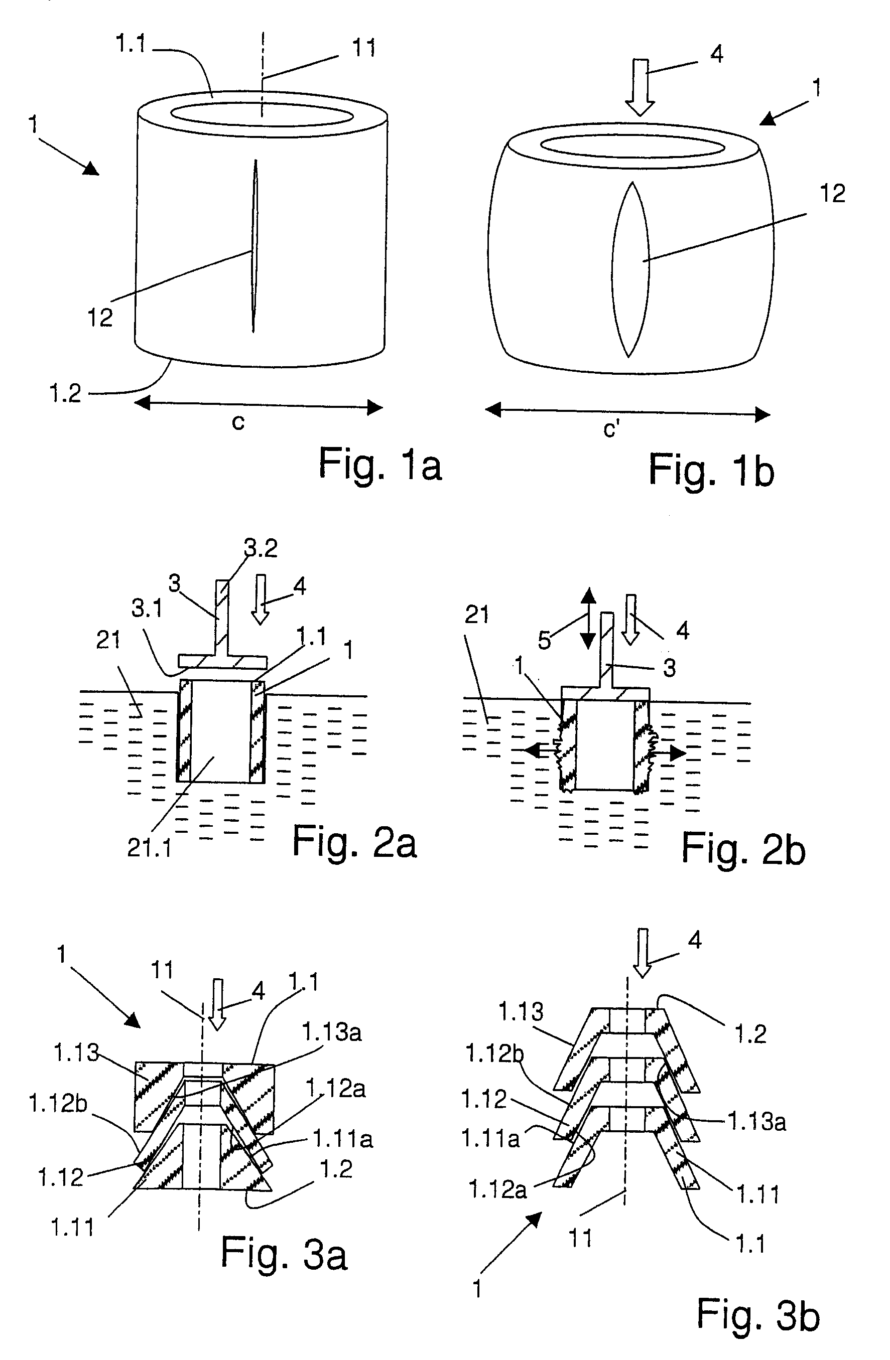 Implant, implantation device, implantation method