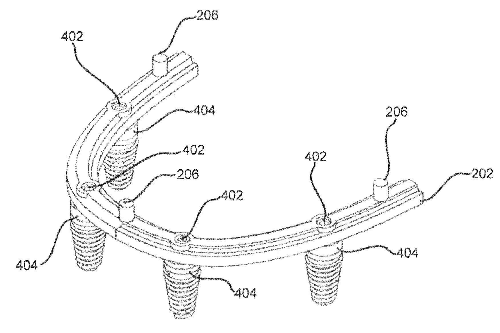 Denture reference and registration system