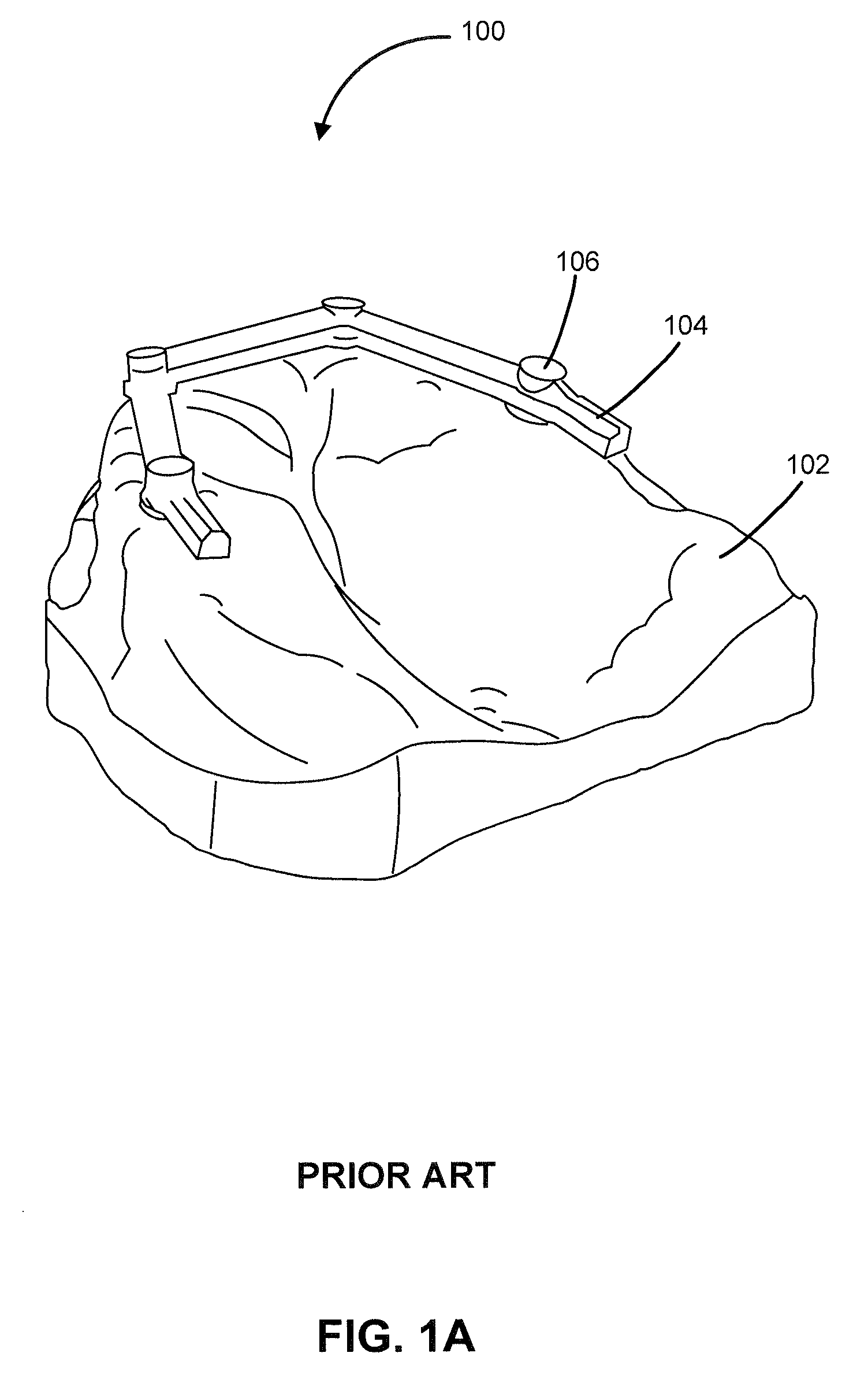 Denture reference and registration system