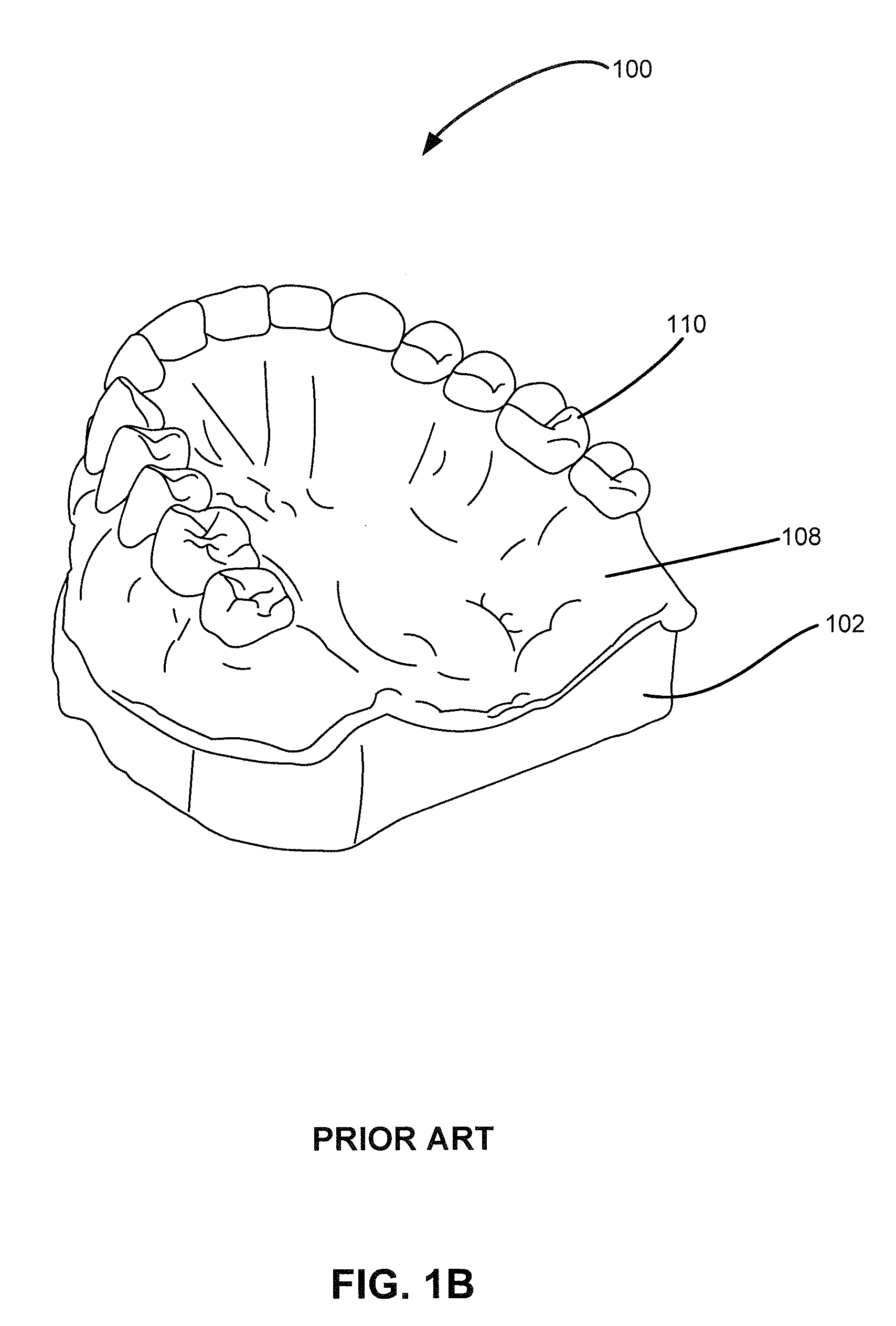 Denture reference and registration system