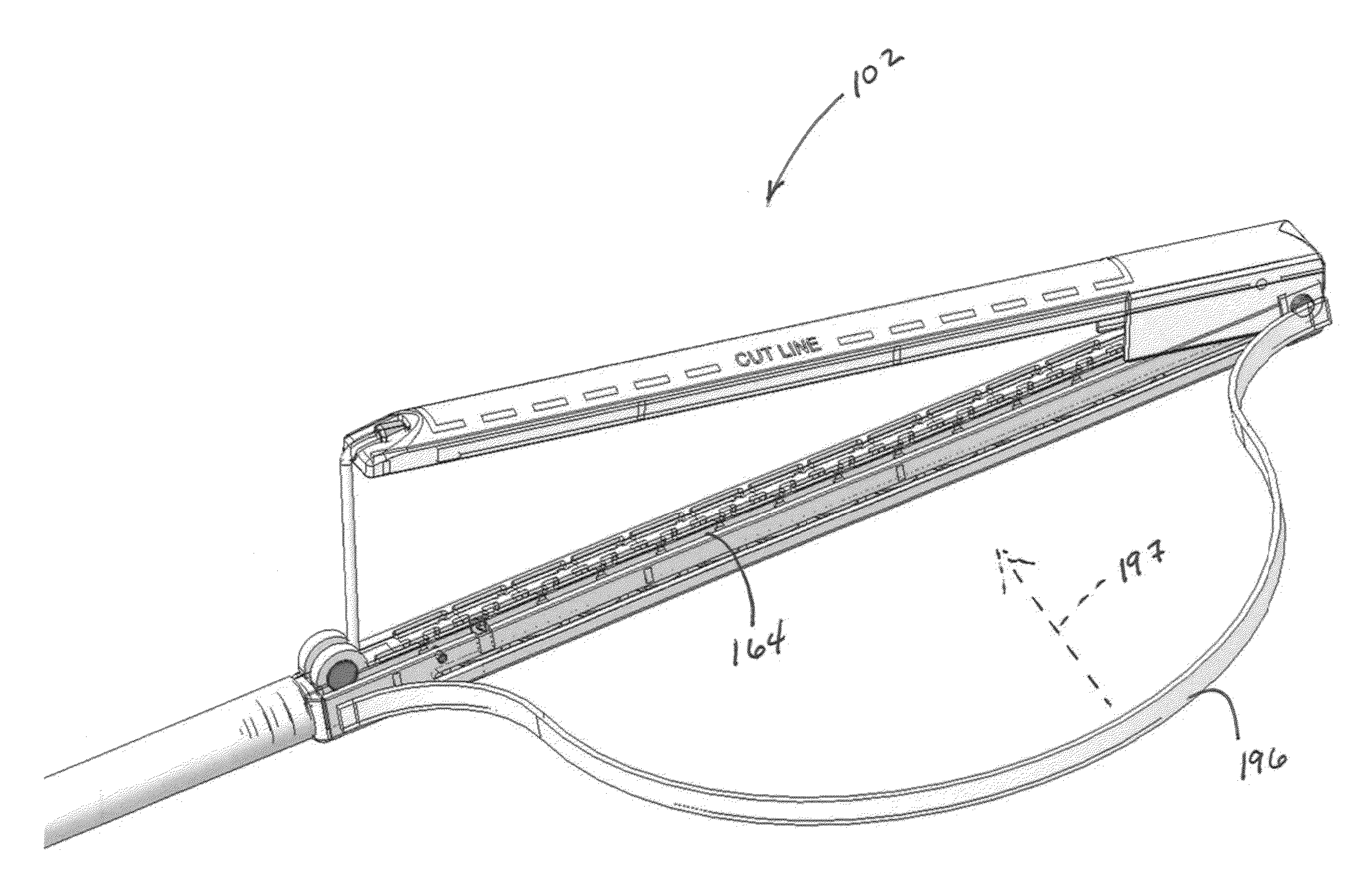 Tissue removal and closure device