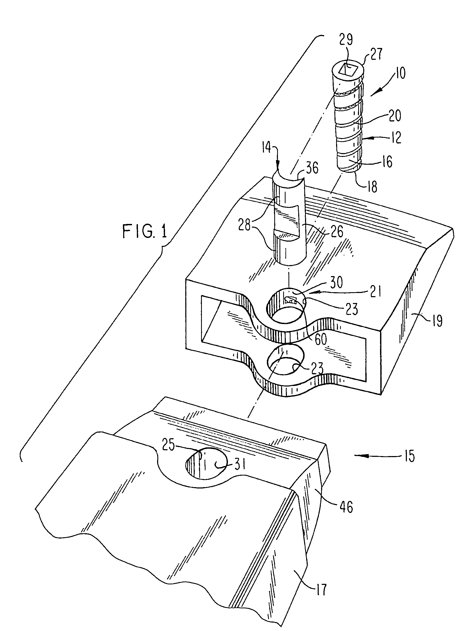 Releasable coupling assembly