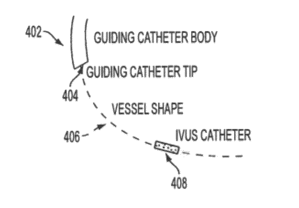 Method and system for image based device tracking for co-registration of angiography and intravascular ultrasound images