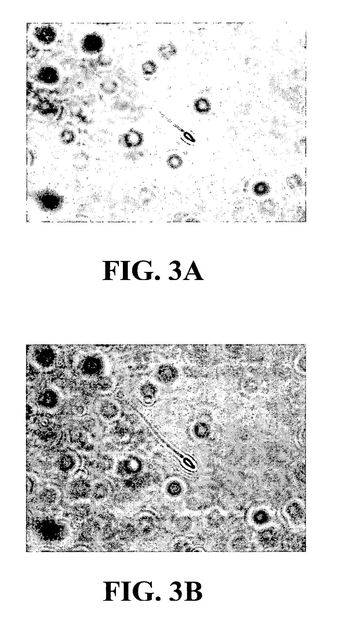 Method for preserving sperm